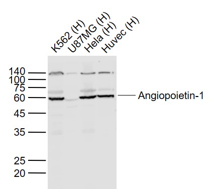 Lane 1: K562 cell lysates; Lane 2: U87MG cell lysates; Lane 3: Hela cell lysates; Lane 4: Huvec cell lysates probed with Angiopoietin 1 Polyclonal Antibody, Unconjugated (bs-0800R) at 1:1000 dilution and 4˚C overnight incubation. Followed by conjugated secondary antibody incubation at 1:20000 for 60 min at 37˚C.