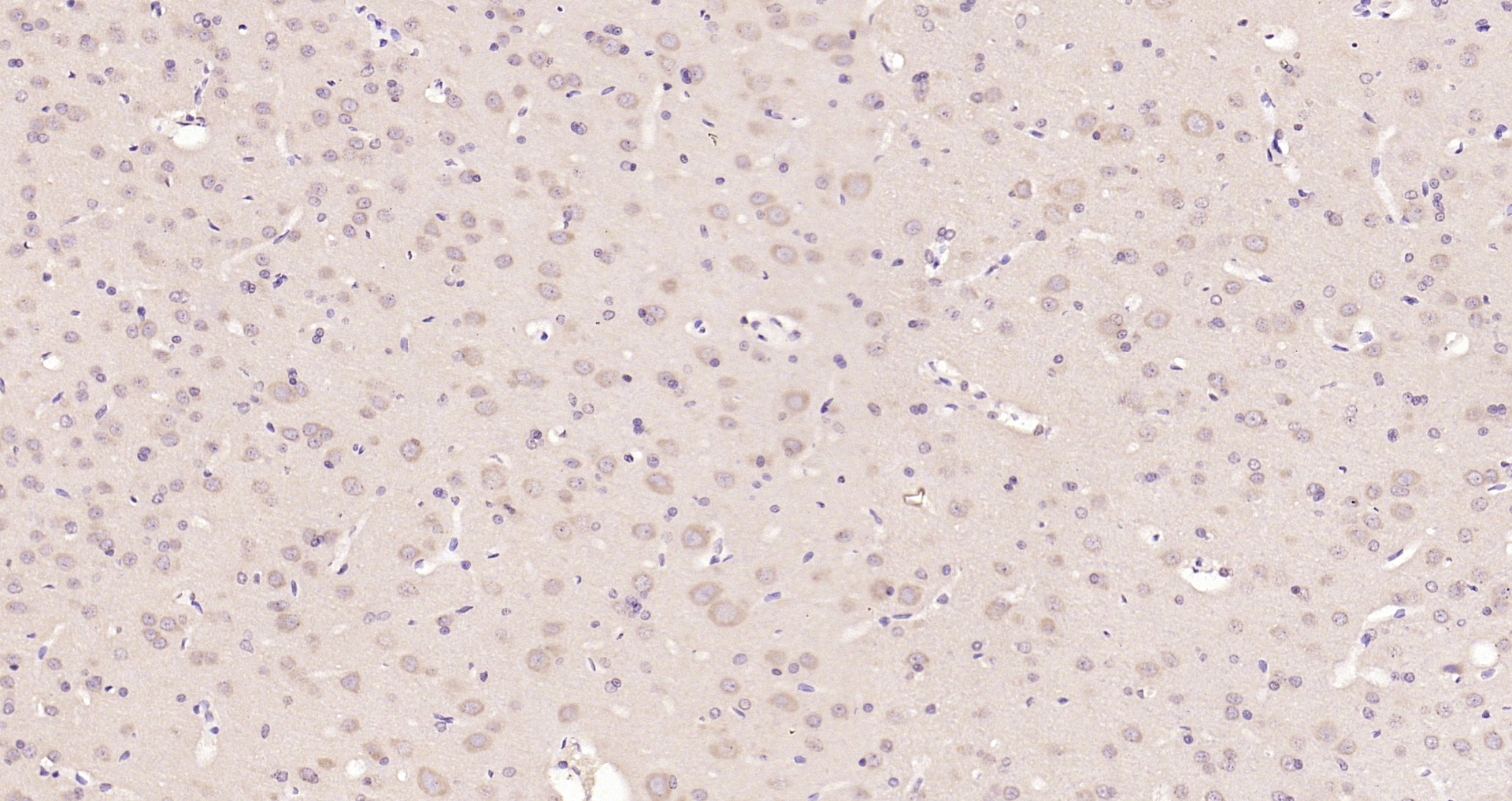Paraformaldehyde-fixed, paraffin embedded Rat brain; Antigen retrieval by boiling in sodium citrate buffer (pH6.0) for 15min; Block endogenous peroxidase by 3% hydrogen peroxide for 20 minutes; Blocking buffer (normal goat serum) at 37°C for 30min; Antibody incubation with 14-3-3 Alpha + Beta + Gamma + Delta + Epsilon Polyclonal Antibody, Unconjugated (bs-0237R) at 1:200 overnight at 4°C, DAB staining.