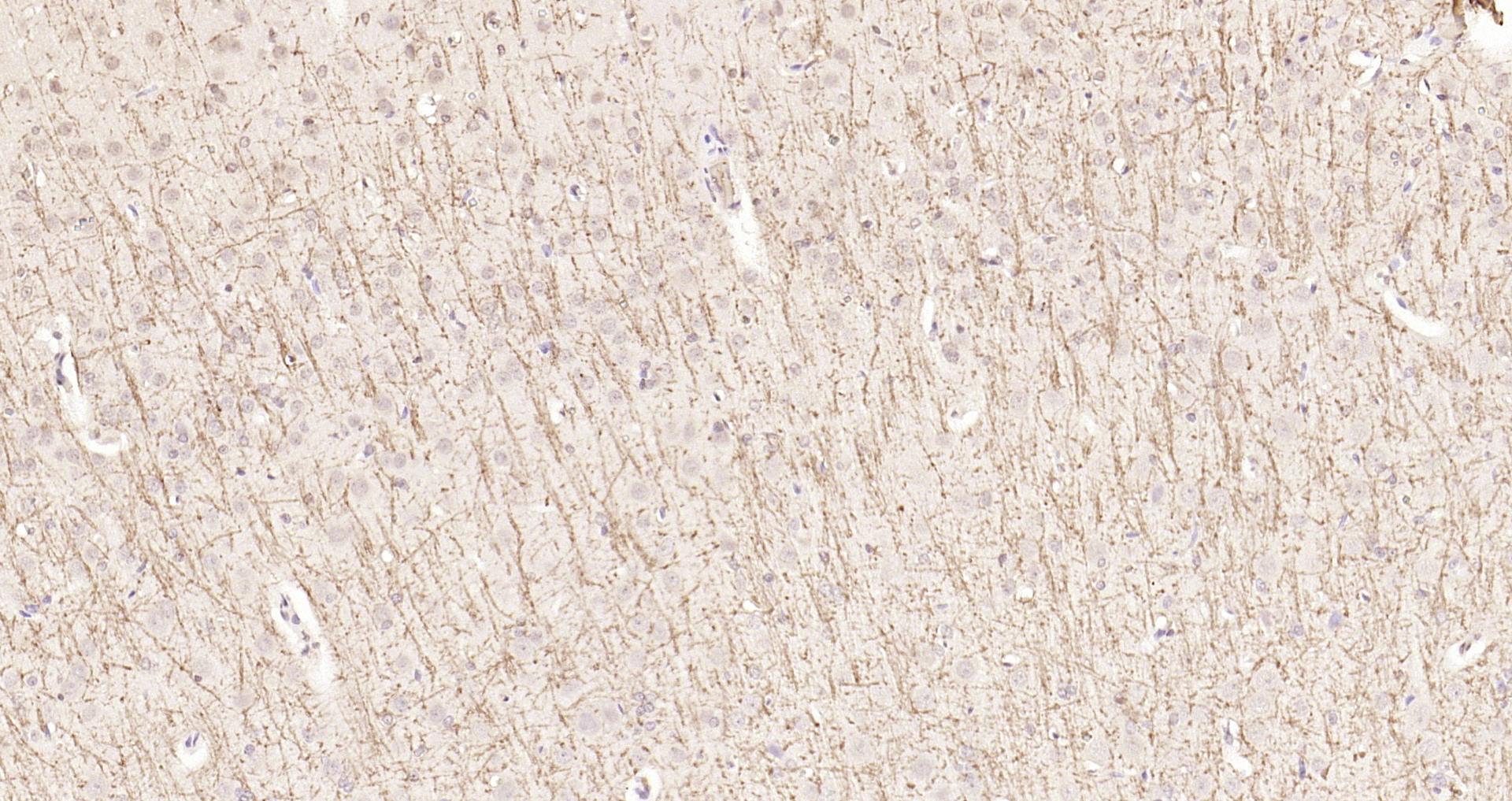 Paraformaldehyde-fixed, paraffin embedded Rat brain; Antigen retrieval by boiling in sodium citrate buffer (pH6.0) for 15min; Block endogenous peroxidase by 3% hydrogen peroxide for 20 minutes; Blocking buffer (normal goat serum) at 37°C for 30min; Antibody incubation with MBP Polyclonal Antibody, Unconjugated (bs-0380R) at 1:200 overnight at 4°C, DAB staining.