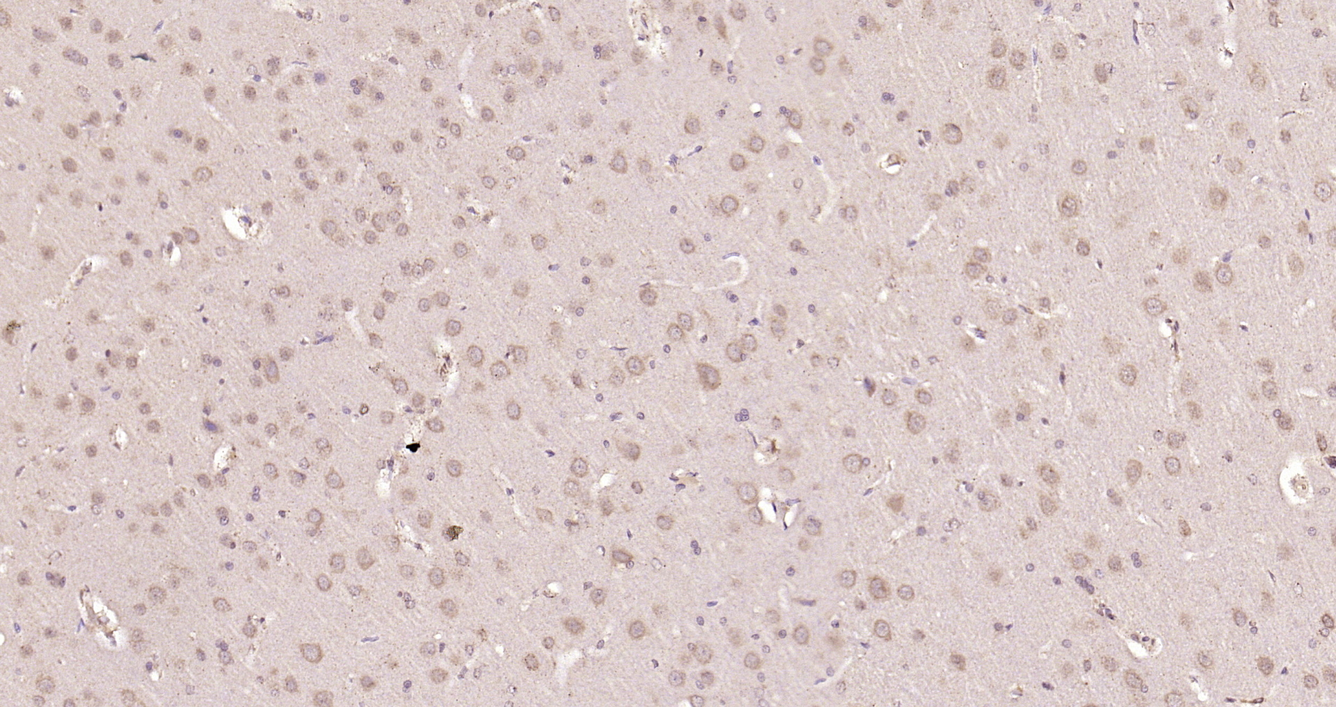 Paraformaldehyde-fixed, paraffin embedded Rat brain; Antigen retrieval by boiling in sodium citrate buffer (pH6.0) for 15min; Block endogenous peroxidase by 3% hydrogen peroxide for 20 minutes; Blocking buffer (normal goat serum) at 37°C for 30min; Antibody incubation with Smad2 Polyclonal Antibody, Unconjugated (bs-0718R) at 1:200 overnight at 4°C, DAB staining. Paraformaldehyde-fixed, paraffin embedded Rat brain; Antigen retrieval by boiling in sodium citrate buffer (pH6.0) for 15min; Block endogenous peroxidase by 3% hydrogen peroxide for 20 minutes; Blocking buffer (normal goat serum) at 37°C for 30min; Antibody incubation with Smad2 Polyclonal Antibody, Unconjugated (bs-0718R) at 1:200 overnight at 4°C, DAB staining.