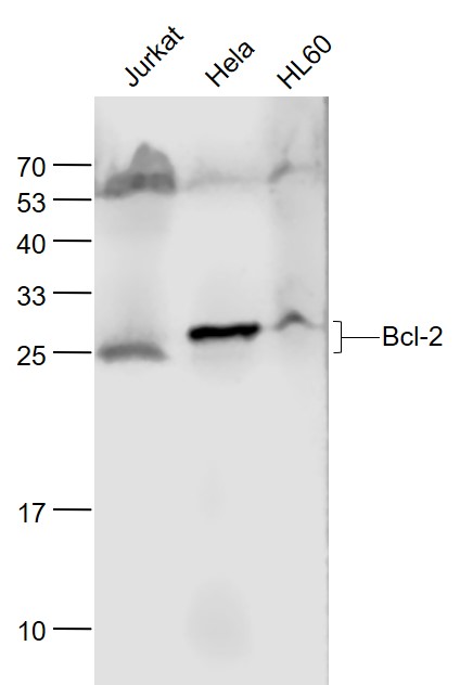 Lane 1: Jurkat cell lysates; Lane 2: Hela cell lysates; Lane 3: HL60 cell lysates probed with Bcl-2 Monoclonal Antibody, Unconjugated (bsm-33047M) at 1:1000 dilution and 4˚C overnight incubation. Followed by conjugated secondary antibody incubation at 1:20000 for 60 min at 37˚C.