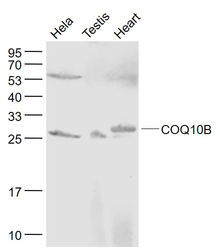 Lane 1:Hela lysates; Lane 2: Mouse Testis lysates; Lane 3: Mouse Heart lysates probed with COQ10B Polyclonal Antibody, Unconjugated (bs-11656R) at 1:1000 dilution and 4˚C overnight incubation. Followed by conjugated secondary antibody incubation at 1:20000 for 60 min at 37˚C.