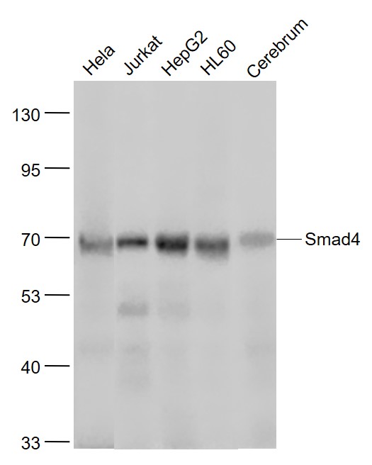 Lane 1: Hela cell lysates; Lane 2: Jurkat cell lysates; Lane 3: HepG2 cell lysates; Lane 4: HL60 cell lysates ; Lane 5:Mouse Cerebrum lysates probed with Smad4 Monoclonal Antibody, Unconjugated (bsm-52225R) at 1:1000 dilution and 4˚C overnight incubation. Followed by conjugated secondary antibody incubation at 1:20000 for 60 min at 37˚C.