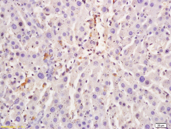 Formalin-fixed and paraffin embedded rat liver tissue labeled with Anti L-Citrulline Polyclonal Antibody, Unconjugated (bs-0619R) at 1:200 followed by conjugation to the secondary antibody and DAB staining