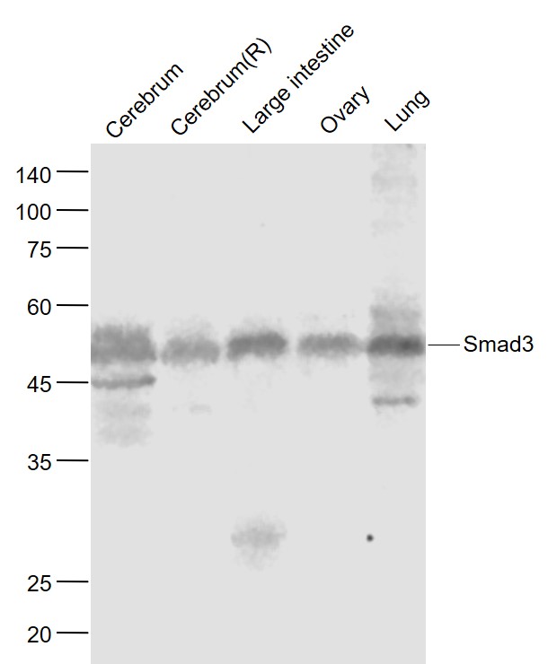 Lane 1: Mouse Cerebrum lysates; Lane 2: Rat Cerebrum lysates; Lane 3: Mouse Large intestine lysates; Lane 4: Mouse Ovary lysates ; Lane 5: Mouse Lung lysates probed with Smad3 Monoclonal Antibody, Unconjugated (bsm-52224R) at 1:1000 dilution and 4˚C overnight incubation. Followed by conjugated secondary antibody incubation at 1:20000 for 60 min at 37˚C.