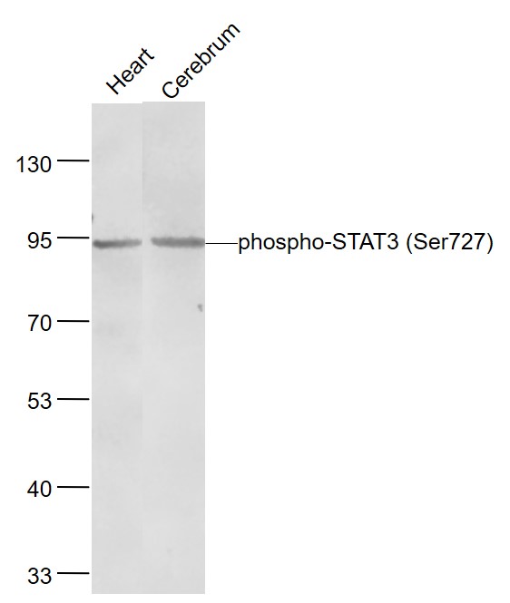 Lane 1:Rat Heart lysates; Lane 2:Rat Cerebrum lysates probed with phospho-STAT3 (Ser727) Monoclonal Antibody, Unconjugated (bsm-52210R) at 1:1000 dilution and 4˚C overnight incubation. Followed by conjugated secondary antibody incubation at 1:20000 for 60 min at 37˚C.