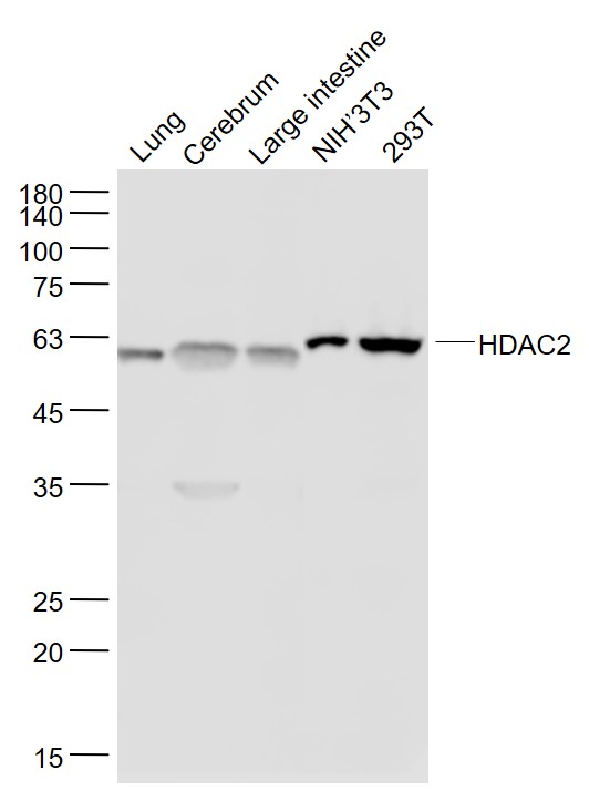 Lane 1: Mouse Lung lysates; Lane 2: Mouse Cerebrum lysates; Lane 3: Mouse Large intestine lysates; Lane 4: NIH\u20193T3 cell lysates ; Lane 5: 293T cell lysates probed with HDAC2 Monoclonal Antibody, Unconjugated (bsm-52082R) at 1:1000 dilution and 4˚C overnight incubation. Followed by conjugated secondary antibody incubation at 1:20000 for 60 min at 37˚C.