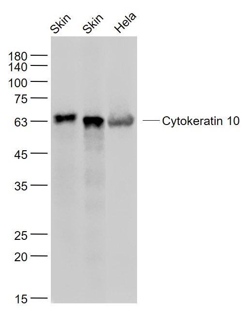 Lane 1: Mouse Skin lysates; Lane 2: Rat Skin lysates; Lane 3: Hela cell lysates probed with Cytokeratin 10 Monoclonal Antibody, Unconjugated (bsm-52052R) at 1:1000 dilution and 4˚C overnight incubation. Followed by conjugated secondary antibody incubation at 1:20000 for 60 min at 37˚C.