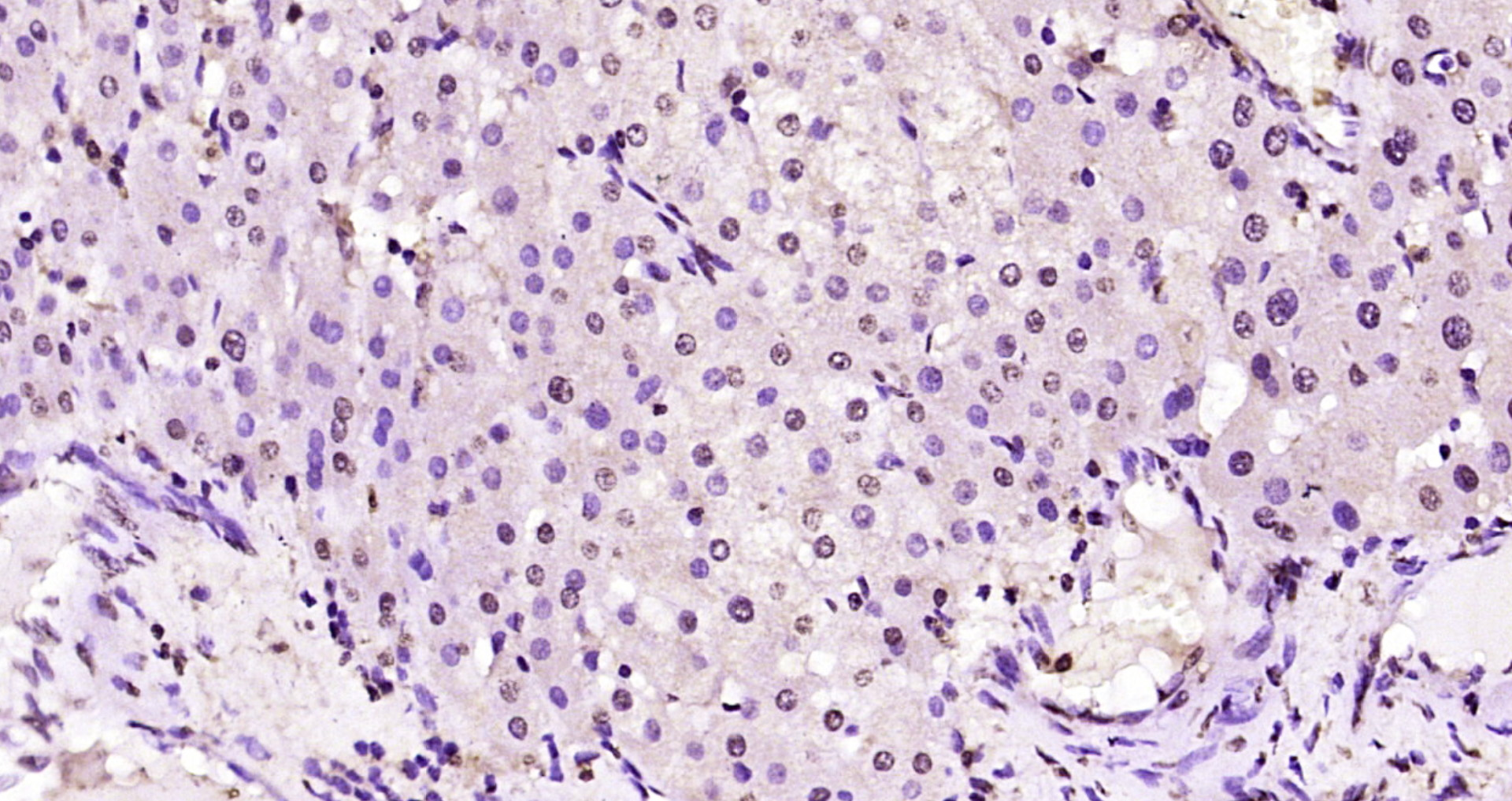 Paraformaldehyde-fixed, paraffin embedded Human liver; Antigen retrieval by boiling in sodium citrate buffer (pH6.0) for 15min; Block endogenous peroxidase by 3% hydrogen peroxide for 20 minutes; Blocking buffer (normal goat serum) at 37°C for 30min; Antibody incubation with ZNF229 Polyclonal Antibody, Unconjugated (bs-7189R) at 1:200 overnight at 4°C, DAB staining.
