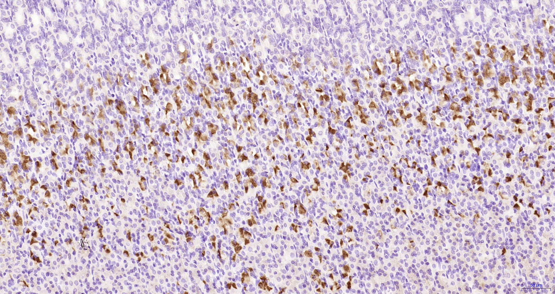 Paraformaldehyde-fixed, paraffin embedded Rat stomach; Antigen retrieval by boiling in sodium citrate buffer (pH6.0) for 15min; Block endogenous peroxidase by 3% hydrogen peroxide for 20 minutes; Blocking buffer (normal goat serum) at 37°C for 30min; Antibody incubation with CQ028 Polyclonal Antibody, Unconjugated (bs-10951R) at 1:200 overnight at 4°C, DAB staining.