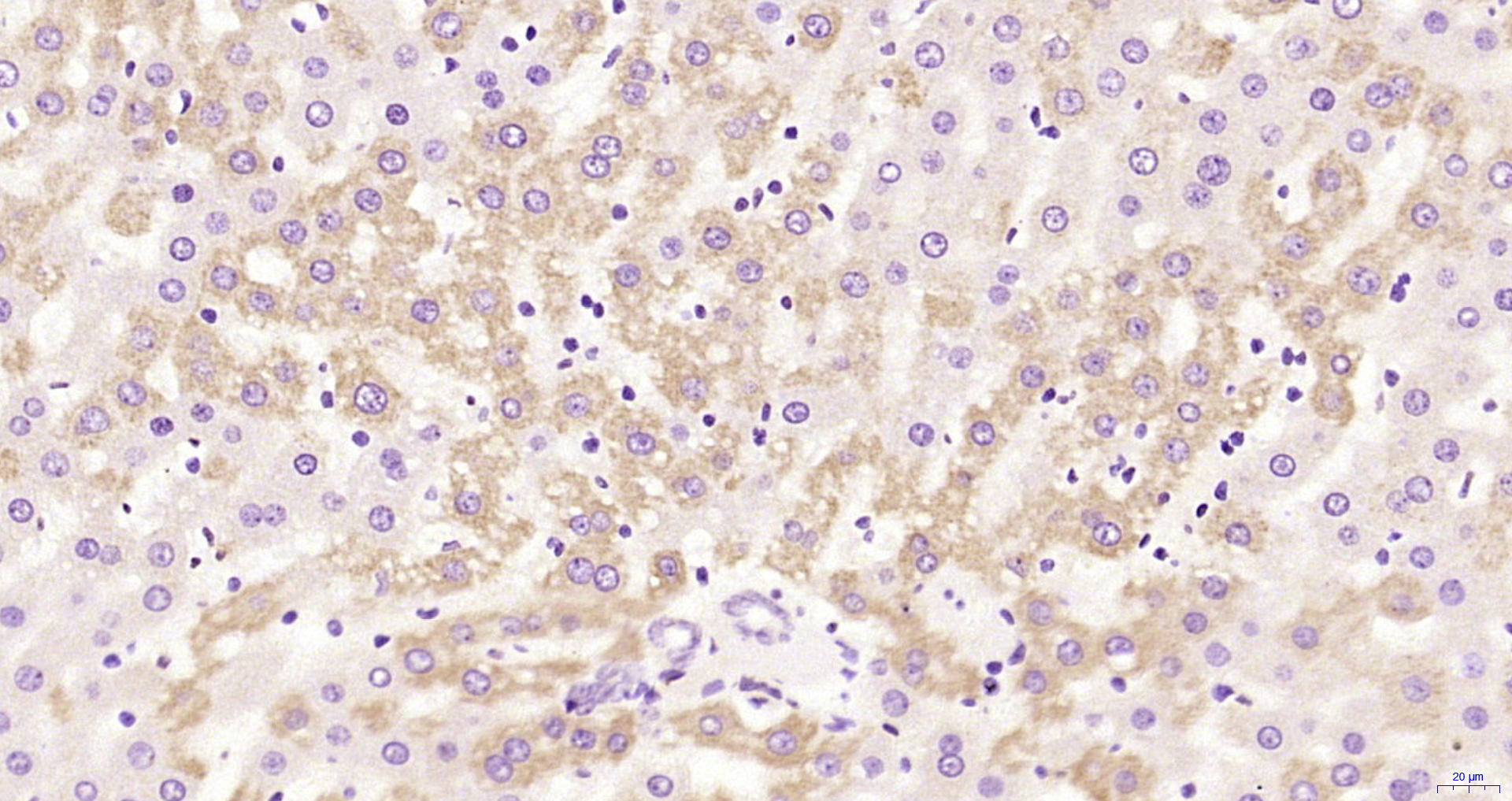 Paraformaldehyde-fixed, paraffin embedded Rat liver; Antigen retrieval by boiling in sodium citrate buffer (pH6.0) for 15min; Block endogenous peroxidase by 3% hydrogen peroxide for 20 minutes; Blocking buffer (normal goat serum) at 37°C for 30min; Antibody incubation with HSD17B11 Polyclonal Antibody, Unconjugated (bs-17400R) at 1:200 overnight at 4°C, DAB staining.