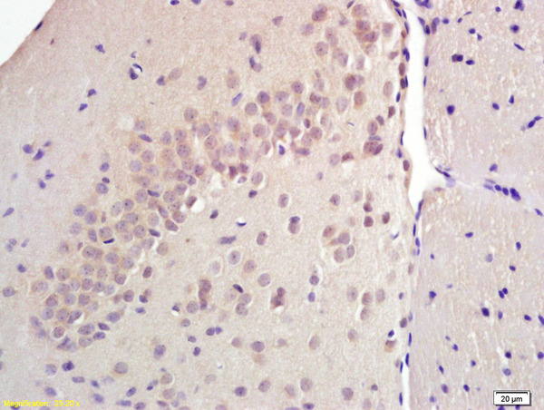 Formalin-fixed and paraffin embedded rat brain labeled with Anti SREBP-1 Polyclonal Antibody, Unconjugated (bs-1402R) at 1:200 followed by conjugation to the secondary antibody and DAB staining