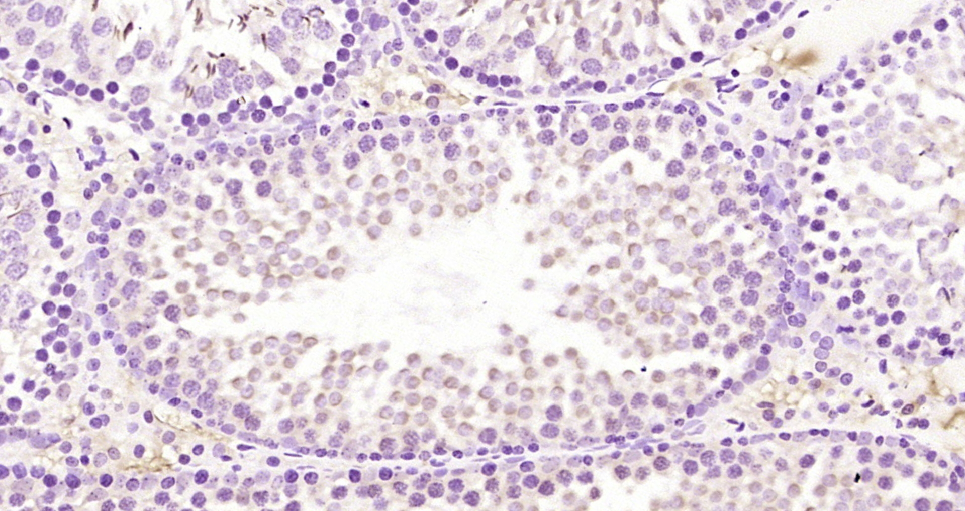 Paraformaldehyde-fixed, paraffin embedded Rat testis; Antigen retrieval by boiling in sodium citrate buffer (pH6.0) for 15min; Block endogenous peroxidase by 3% hydrogen peroxide for 20 minutes; Blocking buffer (normal goat serum) at 37°C for 30min; Antibody incubation with RECQ1 Polyclonal Antibody, Unconjugated (bs-19784R) at 1:200 overnight at 4°C, DAB staining.
