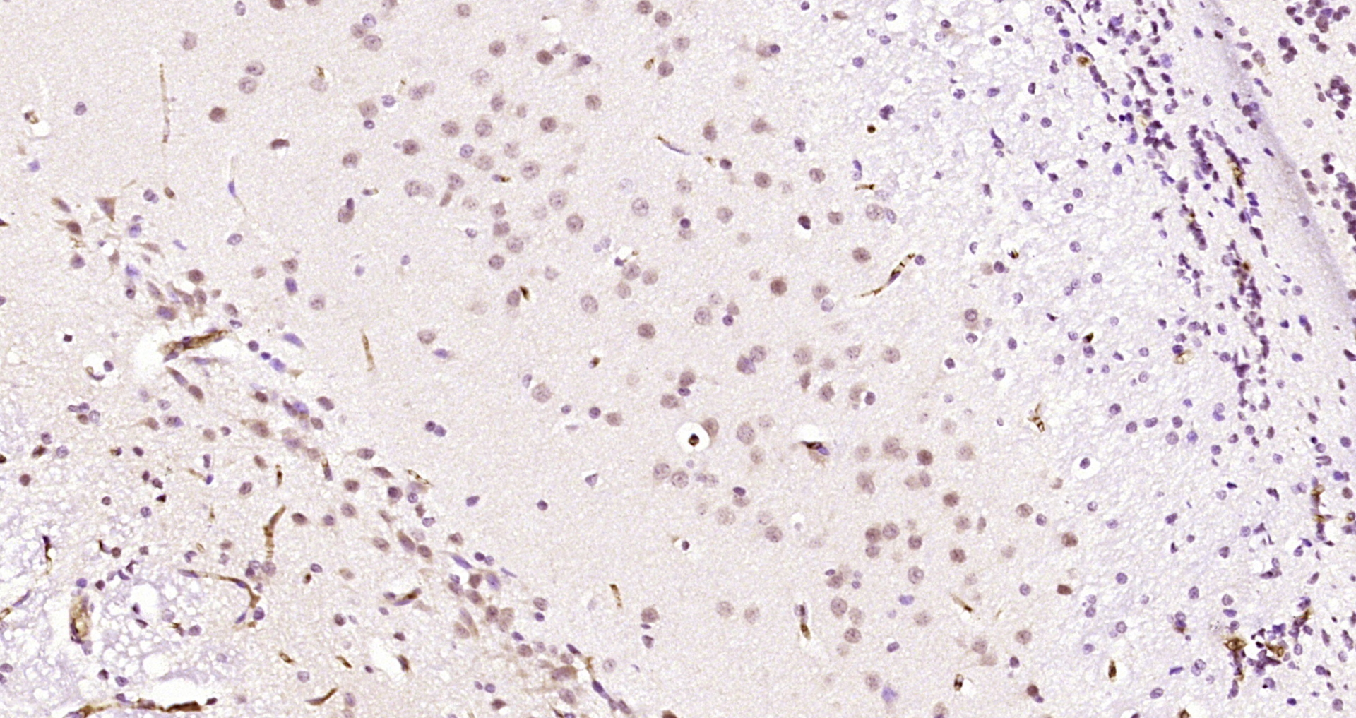Paraformaldehyde-fixed, paraffin embedded Rat brain; Antigen retrieval by boiling in sodium citrate buffer (pH6.0) for 15min; Block endogenous peroxidase by 3% hydrogen peroxide for 20 minutes; Blocking buffer (normal goat serum) at 37°C for 30min; Antibody incubation with RECQ1 Polyclonal Antibody, Unconjugated (bs-19784R) at 1:200 overnight at 4°C, DAB staining.