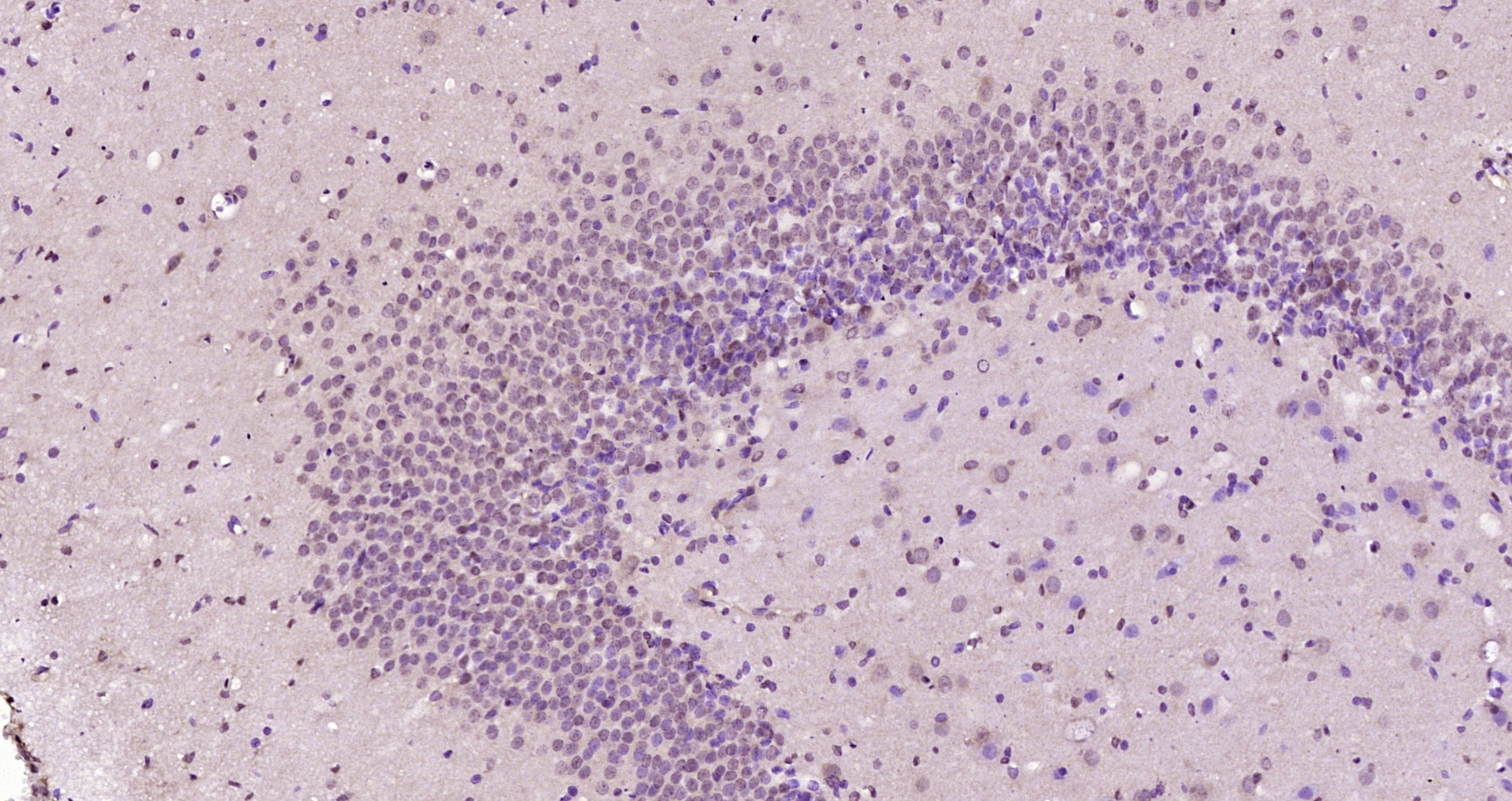 Paraformaldehyde-fixed, paraffin embedded Rat brain; Antigen retrieval by boiling in sodium citrate buffer (pH6.0) for 15min; Block endogenous peroxidase by 3% hydrogen peroxide for 20 minutes; Blocking buffer (normal goat serum) at 37°C for 30min; Antibody incubation with MTA3 Polyclonal Antibody, Unconjugated (bs-20028R) at 1:200 overnight at 4°C, DAB staining.