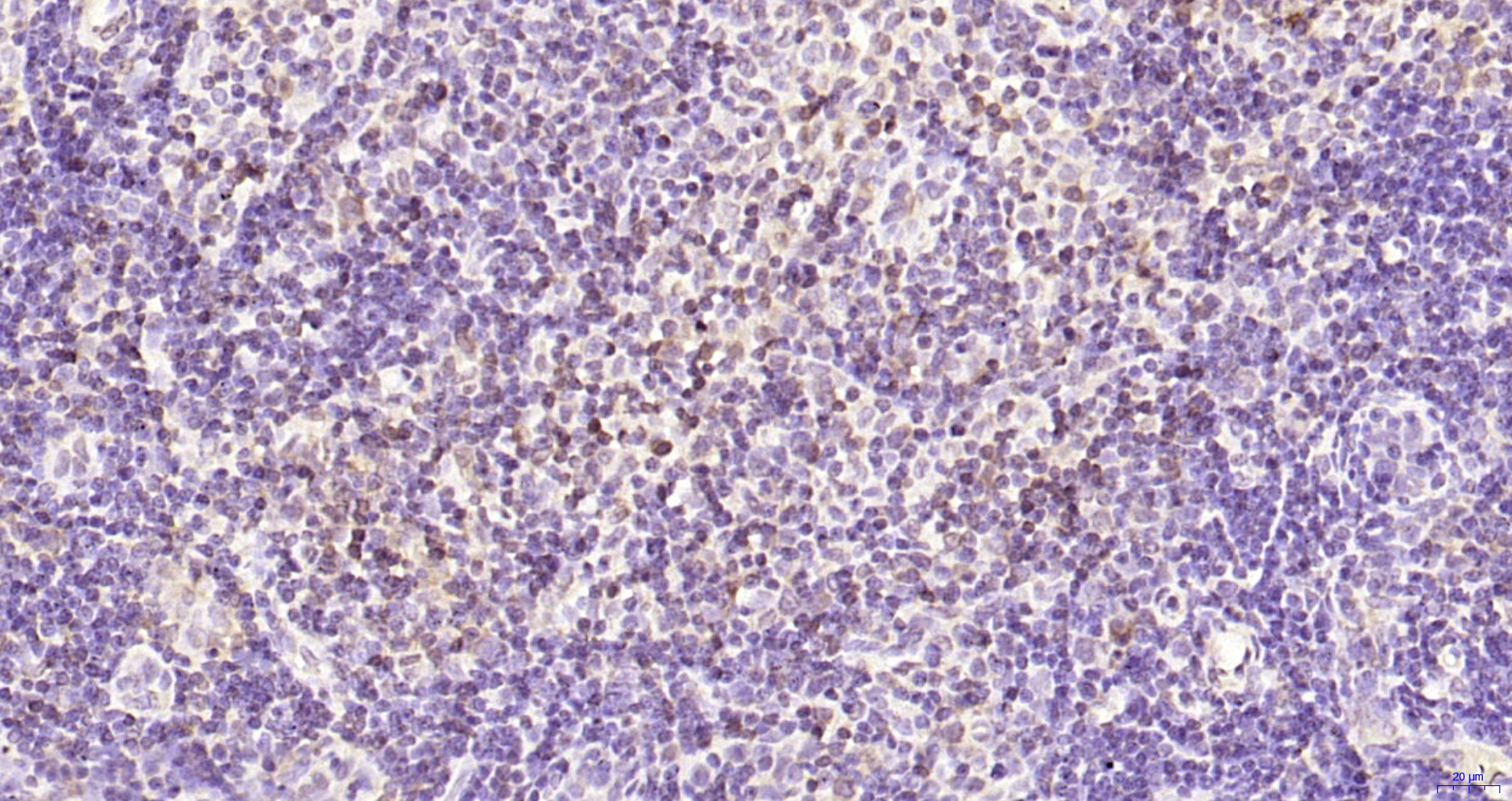Paraformaldehyde-fixed, paraffin embedded Rat lymph node; Antigen retrieval by boiling in sodium citrate buffer (pH6.0) for 15min; Block endogenous peroxidase by 3% hydrogen peroxide for 20 minutes; Blocking buffer (normal goat serum) at 37°C for 30min; Antibody incubation with KIF18B Polyclonal Antibody, Unconjugated (bs-22415R) at 1:200 overnight at 4°C, DAB staining.