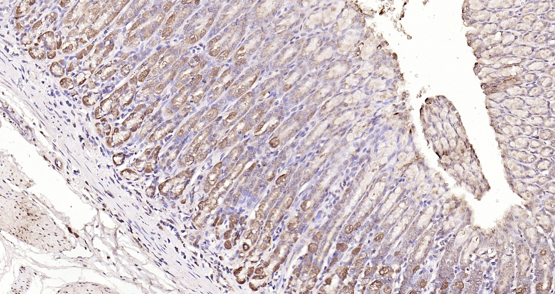 Paraformaldehyde-fixed, paraffin embedded Rat stomach; Antigen retrieval by boiling in sodium citrate buffer (pH6.0) for 15min; Block endogenous peroxidase by 3% hydrogen peroxide for 20 minutes; Blocking buffer (normal goat serum) at 37°C for 30min; Antibody incubation with MMP-1 Polyclonal Antibody, Unconjugated (bs-4597R) at 1:200 overnight at 4°C, DAB staining.