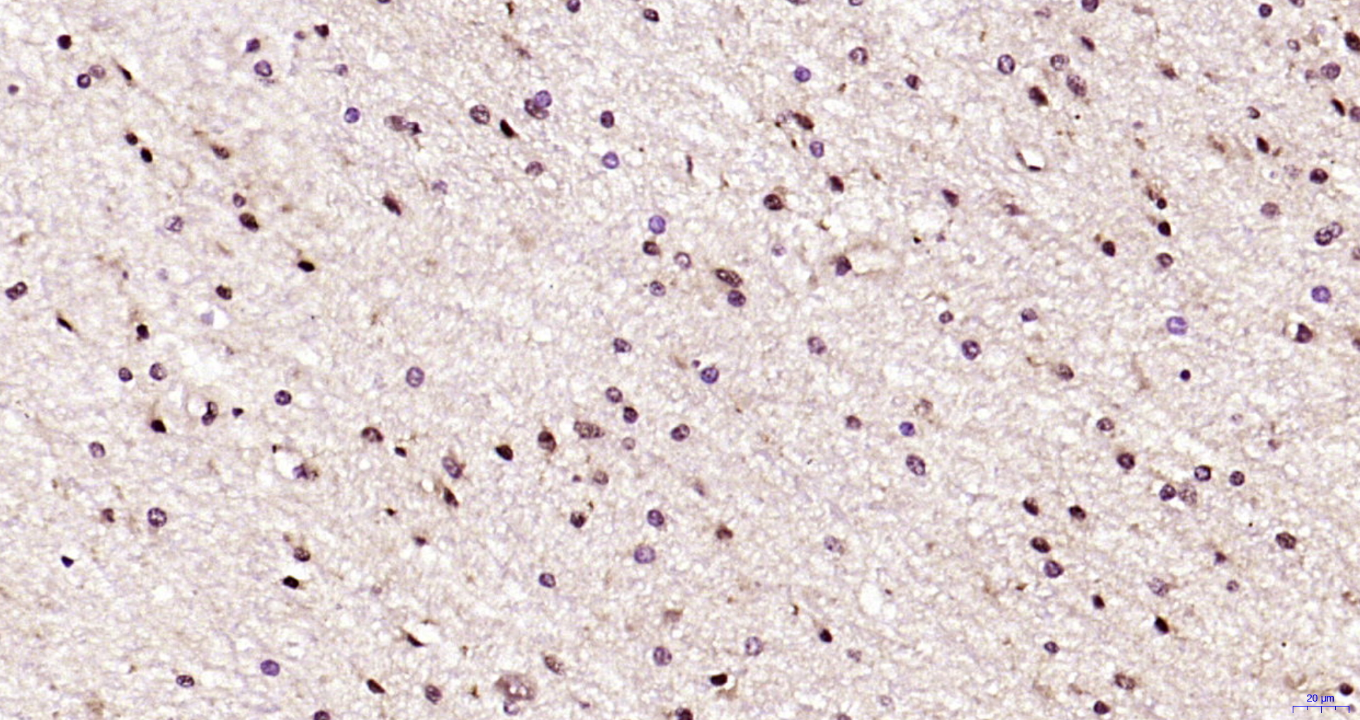 Paraformaldehyde-fixed, paraffin embedded Human brain; Antigen retrieval by boiling in sodium citrate buffer (pH6.0) for 15min; Block endogenous peroxidase by 3% hydrogen peroxide for 20 minutes; Blocking buffer (normal goat serum) at 37°C for 30min; Antibody incubation with PEG3 Polyclonal Antibody, Unconjugated (bs-22782R) at 1:200 overnight at 4°C, DAB staining. Paraformaldehyde-fixed, paraffin embedded Human brain; Antigen retrieval by boiling in sodium citrate buffer (pH6.0) for 15min; Block endogenous peroxidase by 3% hydrogen peroxide for 20 minutes; Blocking buffer (normal goat serum) at 37°C for 30min; Antibody incubation with PEG3 Polyclonal Antibody, Unconjugated (bs-22782R) at 1:200 overnight at 4°C, DAB staining.