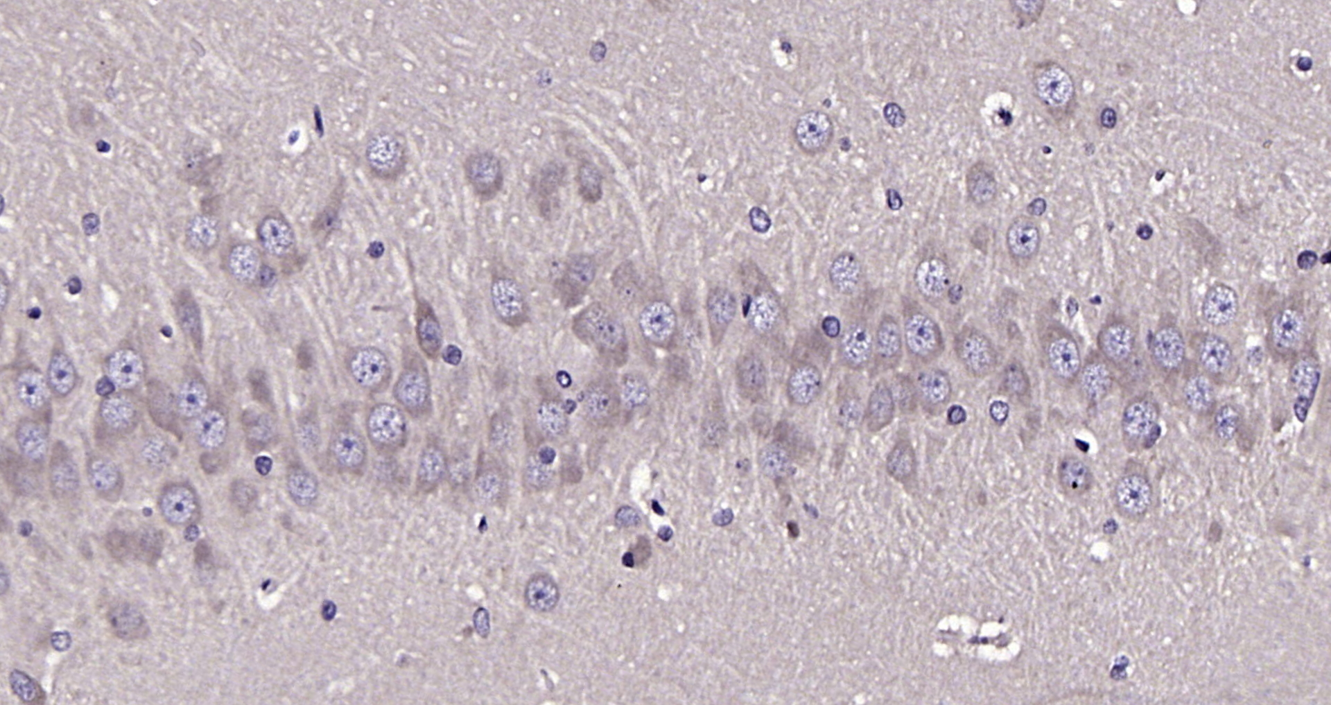 Paraformaldehyde-fixed, paraffin embedded Rat brain; Antigen retrieval by boiling in sodium citrate buffer (pH6.0) for 15min; Block endogenous peroxidase by 3% hydrogen peroxide for 20 minutes; Blocking buffer (normal goat serum) at 37°C for 30min; Antibody incubation with ATG13 Polyclonal Antibody, Unconjugated (bs-22897R) at 1:200 overnight at 4°C, DAB staining.