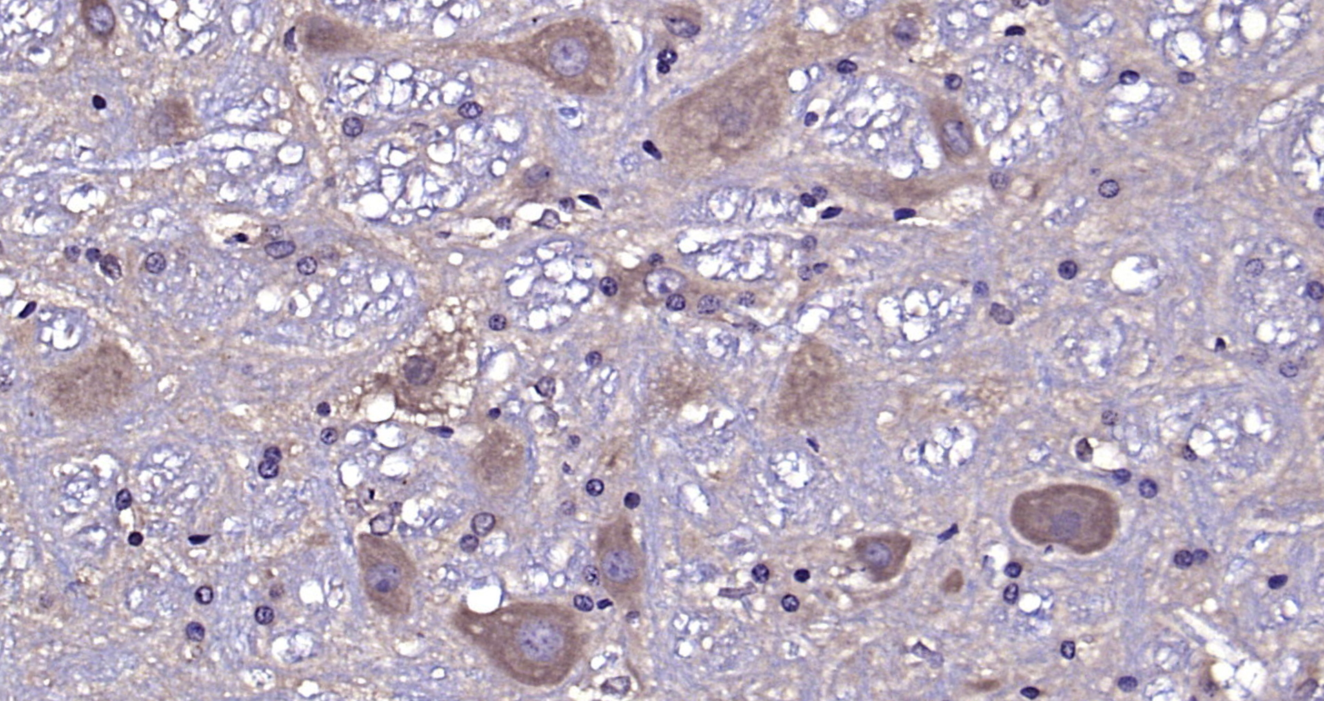 Paraformaldehyde-fixed, paraffin embedded Rat cerebellum; Antigen retrieval by boiling in sodium citrate buffer (pH6.0) for 15min; Block endogenous peroxidase by 3% hydrogen peroxide for 20 minutes; Blocking buffer (normal goat serum) at 37°C for 30min; Antibody incubation with ATG13 Polyclonal Antibody, Unconjugated (bs-22897R) at 1:200 overnight at 4°C, DAB staining.