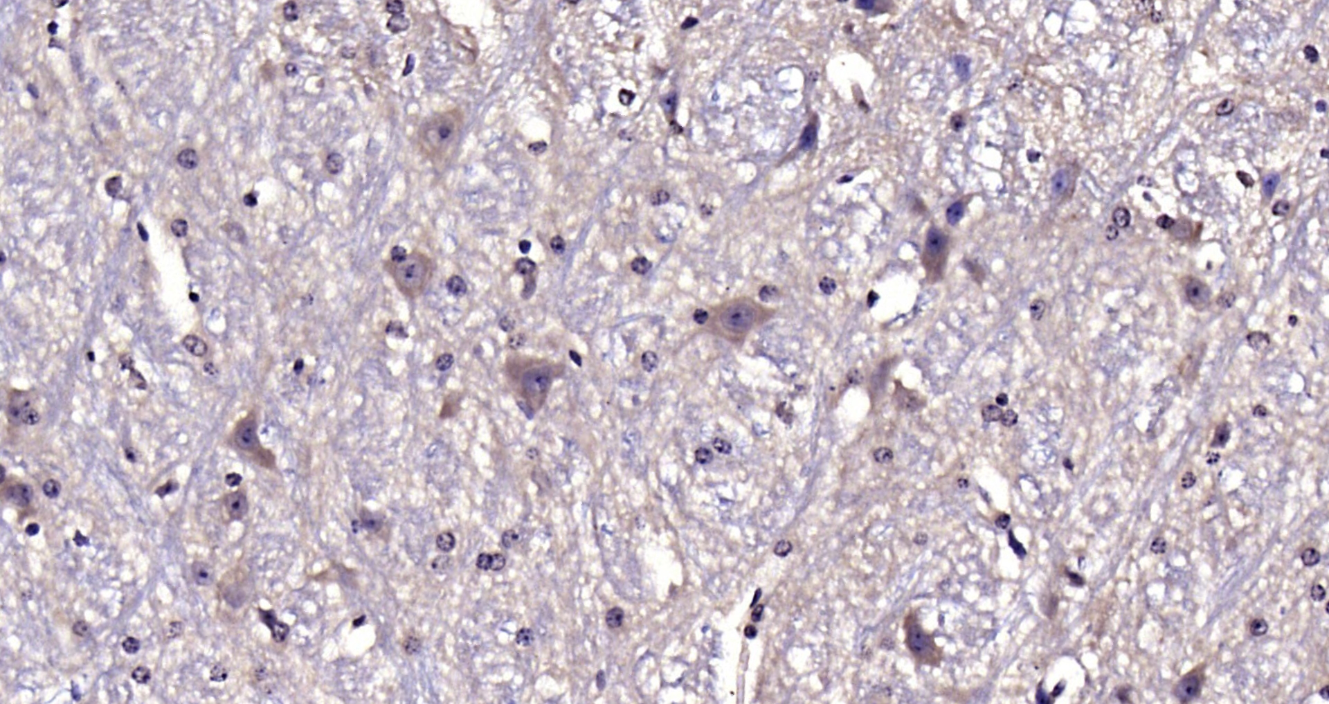 Paraformaldehyde-fixed, paraffin embedded Mouse cerebellum; Antigen retrieval by boiling in sodium citrate buffer (pH6.0) for 15min; Block endogenous peroxidase by 3% hydrogen peroxide for 20 minutes; Blocking buffer (normal goat serum) at 37°C for 30min; Antibody incubation with ATG13 Polyclonal Antibody, Unconjugated (bs-22897R) at 1:200 overnight at 4°C, DAB staining.