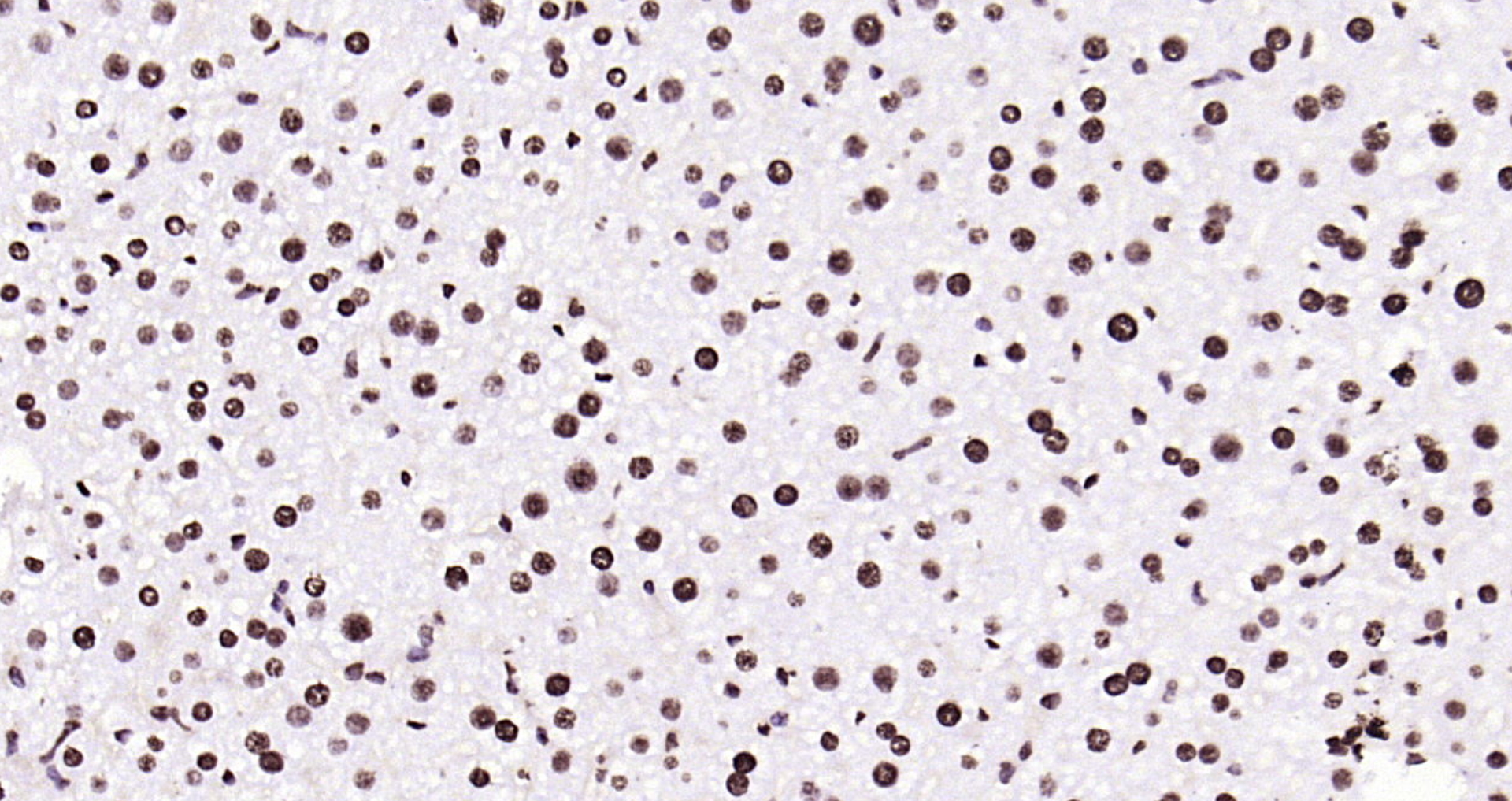 Paraformaldehyde-fixed, paraffin embedded Rat liver; Antigen retrieval by boiling in sodium citrate buffer (pH6.0) for 15min; Block endogenous peroxidase by 3% hydrogen peroxide for 20 minutes; Blocking buffer (normal goat serum) at 37°C for 30min; Antibody incubation with Histone H3 (tri methyl K79) Monoclonal Antibody, Unconjugated (bsm-33097M) at 1:200 overnight at 4°C, DAB staining.