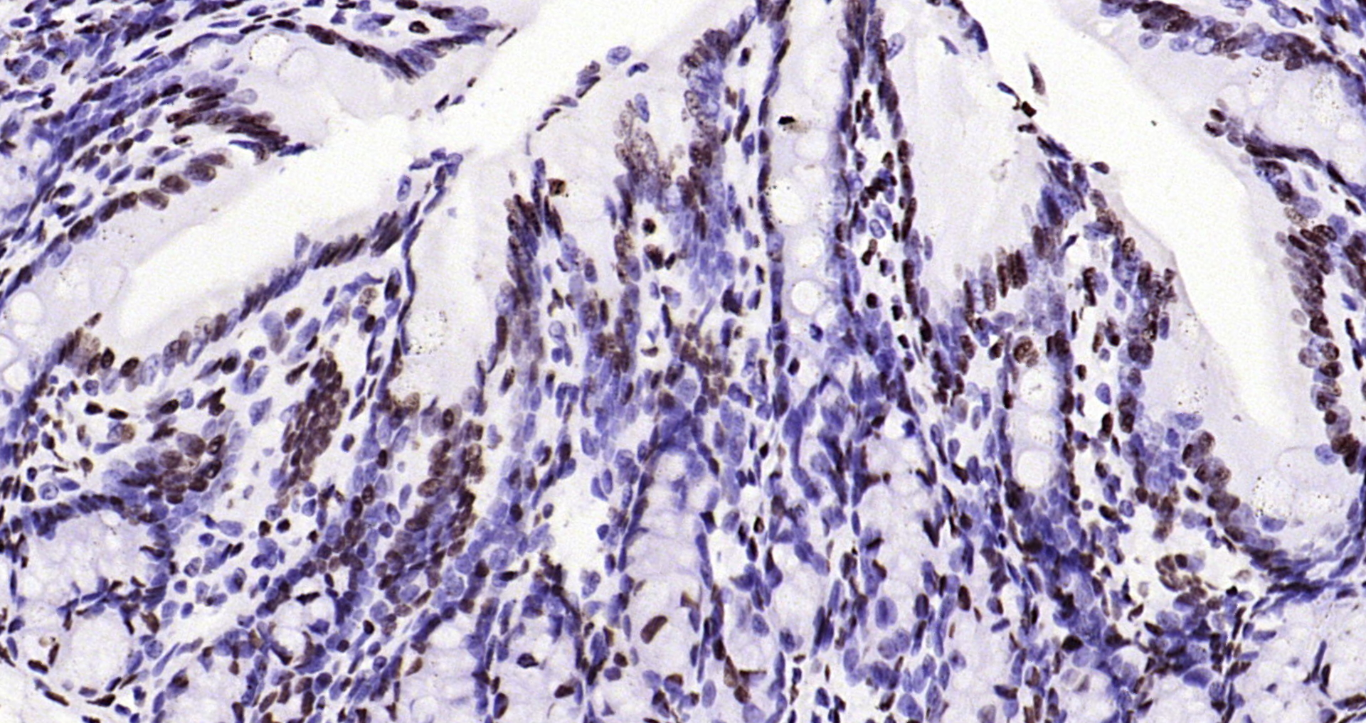 Paraformaldehyde-fixed, paraffin embedded Rat colon; Antigen retrieval by boiling in sodium citrate buffer (pH6.0) for 15min; Block endogenous peroxidase by 3% hydrogen peroxide for 20 minutes; Blocking buffer (normal goat serum) at 37°C for 30min; Antibody incubation with Histone H3 (tri methyl K79) Monoclonal Antibody, Unconjugated (bsm-33097M) at 1:200 overnight at 4°C, DAB staining.