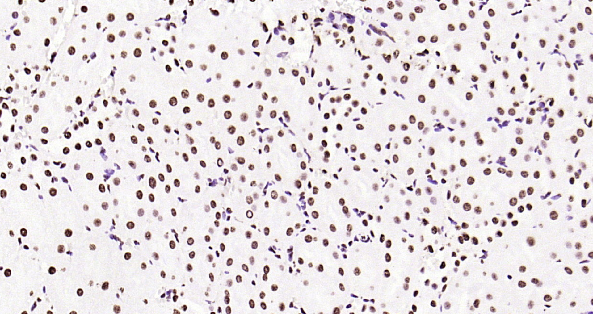 Paraformaldehyde-fixed, paraffin embedded Rat kidney; Antigen retrieval by boiling in sodium citrate buffer (pH6.0) for 15min; Block endogenous peroxidase by 3% hydrogen peroxide for 20 minutes; Blocking buffer (normal goat serum) at 37°C for 30min; Antibody incubation with Histone H3 (tri methyl K79) Monoclonal Antibody, Unconjugated (bsm-33097M) at 1:200 overnight at 4°C, DAB staining.