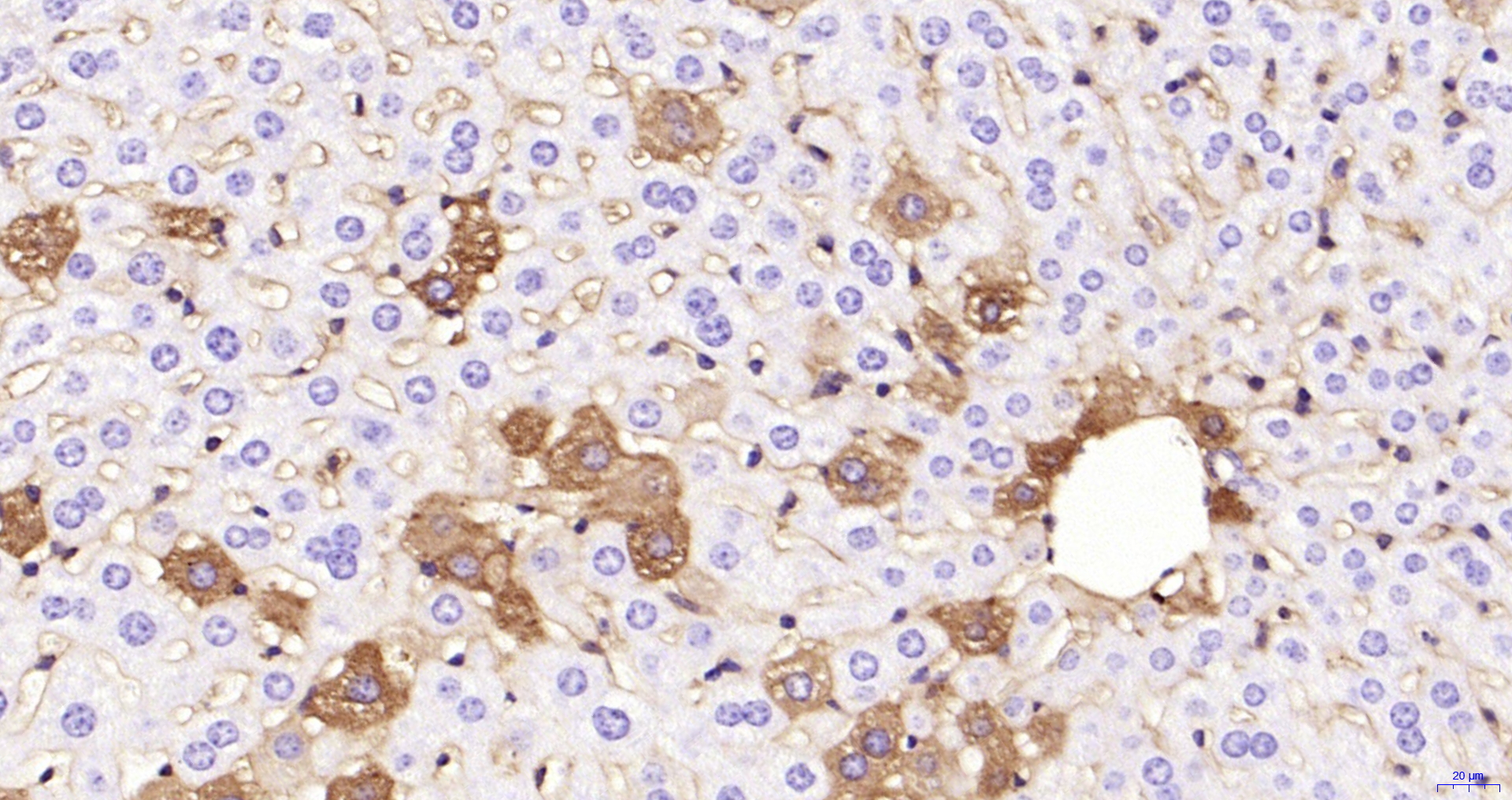 Paraformaldehyde-fixed, paraffin embedded Mouse liver; Antigen retrieval by boiling in sodium citrate buffer (pH6.0) for 15min; Block endogenous peroxidase by 3% hydrogen peroxide for 20 minutes; Blocking buffer (normal goat serum) at 37°C for 30min; Antibody incubation with ANGPTL8 Monoclonal Antibody, Unconjugated (bsm-49019M) at 1:200 overnight at 4°C, DAB staining.