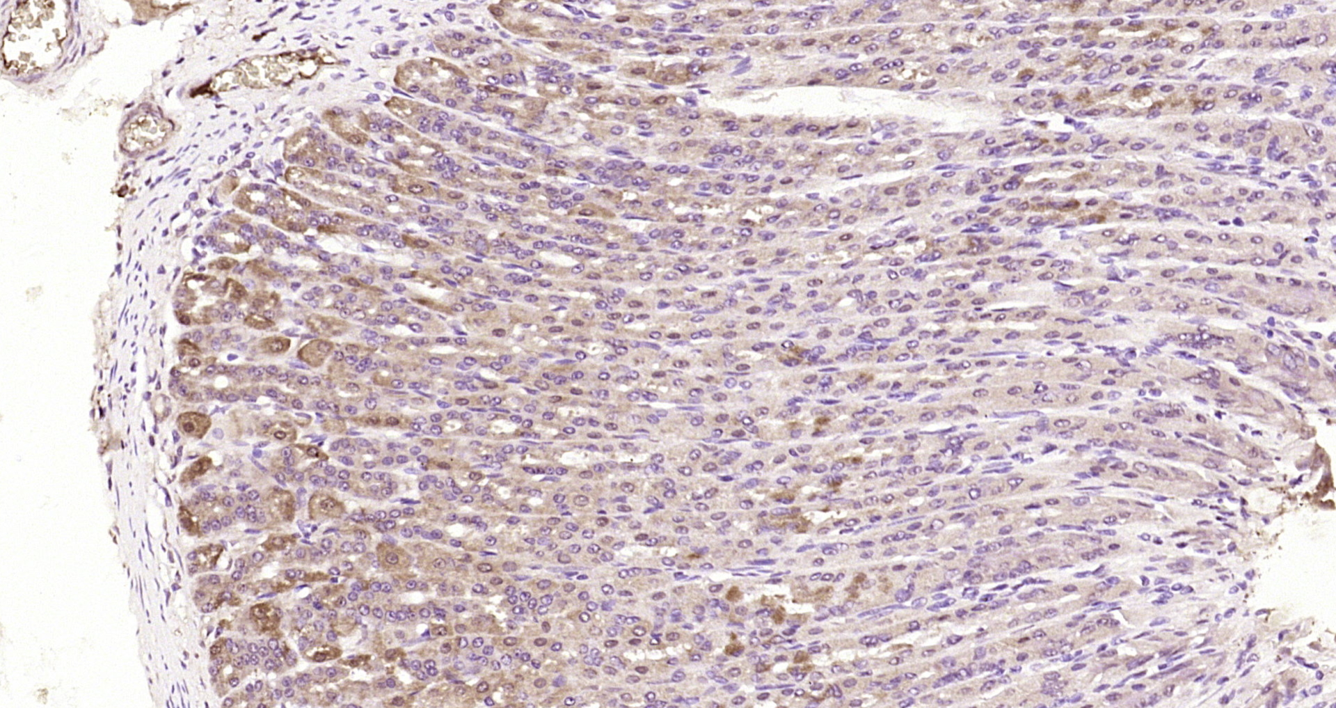 Paraformaldehyde-fixed, paraffin embedded Rat stomach; Antigen retrieval by boiling in sodium citrate buffer (pH6.0) for 15min; Block endogenous peroxidase by 3% hydrogen peroxide for 20 minutes; Blocking buffer (normal goat serum) at 37°C for 30min; Antibody incubation with EAP30 Polyclonal Antibody, Unconjugated (bs-14482R) at 1:200 overnight at 4°C, DAB staining.