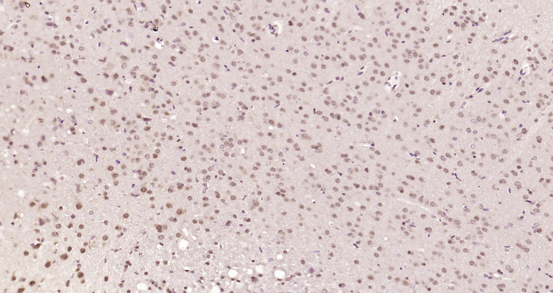 Paraformaldehyde-fixed, paraffin embedded Rat brain; Antigen retrieval by boiling in sodium citrate buffer (pH6.0) for 15min; Block endogenous peroxidase by 3% hydrogen peroxide for 20 minutes; Blocking buffer (normal goat serum) at 37°C for 30min; Antibody incubation with WTX Polyclonal Antibody, Unconjugated (bs-14710R) at 1:200 overnight at 4°C, DAB staining. Paraformaldehyde-fixed, paraffin embedded Rat brain; Antigen retrieval by boiling in sodium citrate buffer (pH6.0) for 15min; Block endogenous peroxidase by 3% hydrogen peroxide for 20 minutes; Blocking buffer (normal goat serum) at 37°C for 30min; Antibody incubation with WTX Polyclonal Antibody, Unconjugated (bs-14710R) at 1:200 overnight at 4°C, DAB staining.