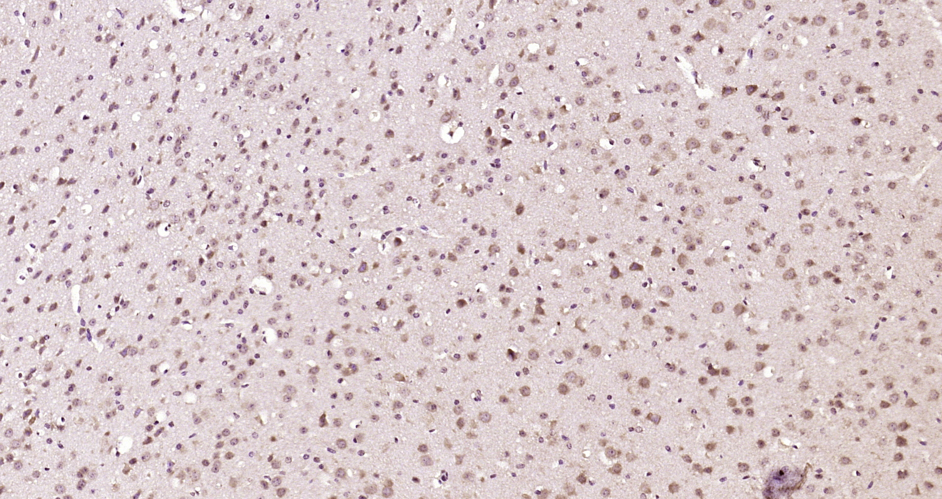 Paraformaldehyde-fixed, paraffin embedded Mouse brain; Antigen retrieval by boiling in sodium citrate buffer (pH6.0) for 15min; Block endogenous peroxidase by 3% hydrogen peroxide for 20 minutes; Blocking buffer (normal goat serum) at 37°C for 30min; Antibody incubation with FAM175B Polyclonal Antibody, Unconjugated (bs-14763R) at 1:200 overnight at 4°C, DAB staining.