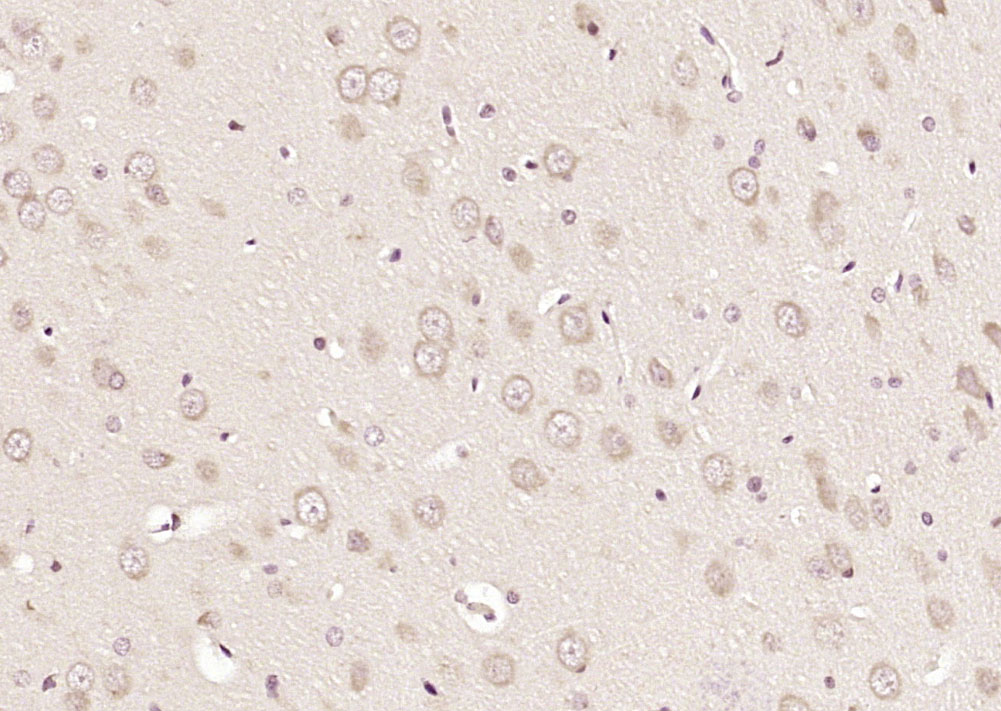 Paraformaldehyde-fixed, paraffin embedded Rat brain; Antigen retrieval by boiling in sodium citrate buffer (pH6.0) for 15min; Block endogenous peroxidase by 3% hydrogen peroxide for 20 minutes; Blocking buffer (normal goat serum) at 37°C for 30min; Antibody incubation with FKBP1B Polyclonal Antibody, Unconjugated (bs-16093R) at 1:200 overnight at 4°C, DAB staining.