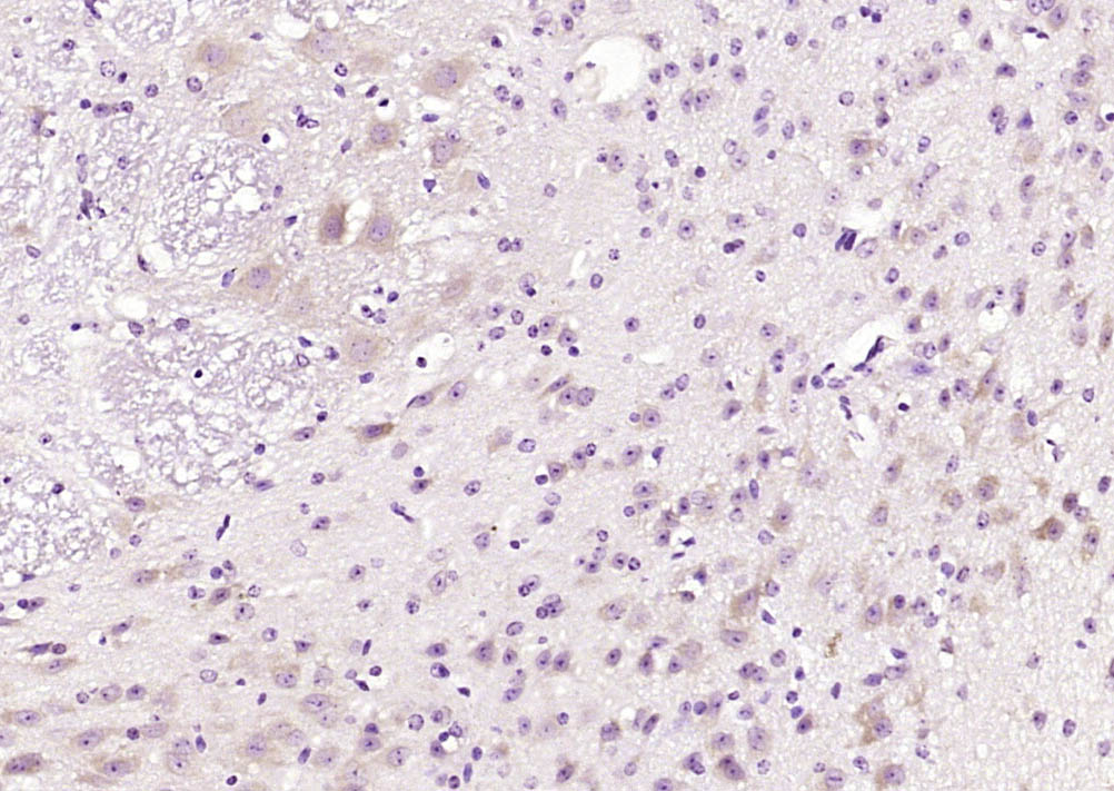Paraformaldehyde-fixed, paraffin embedded Mouse cerebellum; Antigen retrieval by boiling in sodium citrate buffer (pH6.0) for 15min; Block endogenous peroxidase by 3% hydrogen peroxide for 20 minutes; Blocking buffer (normal goat serum) at 37°C for 30min; Antibody incubation with FKBP1B Polyclonal Antibody, Unconjugated (bs-16093R) at 1:200 overnight at 4°C, DAB staining.