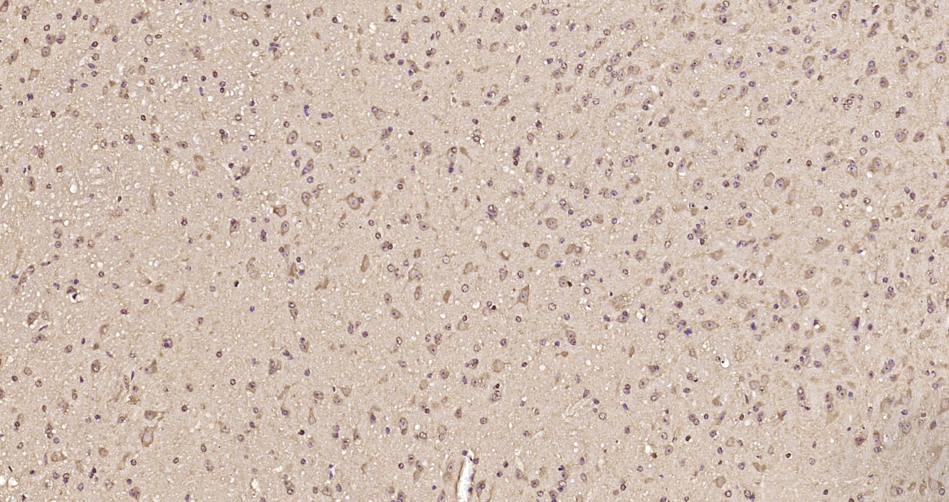 Paraformaldehyde-fixed, paraffin embedded Mouse brain; Antigen retrieval by boiling in sodium citrate buffer (pH6.0) for 15min; Block endogenous peroxidase by 3% hydrogen peroxide for 20 minutes; Blocking buffer (normal goat serum) at 37°C for 30min; Antibody incubation with KCNK1 Polyclonal Antibody, Unconjugated (bs-16893R) at 1:200 overnight at 4°C, DAB staining.