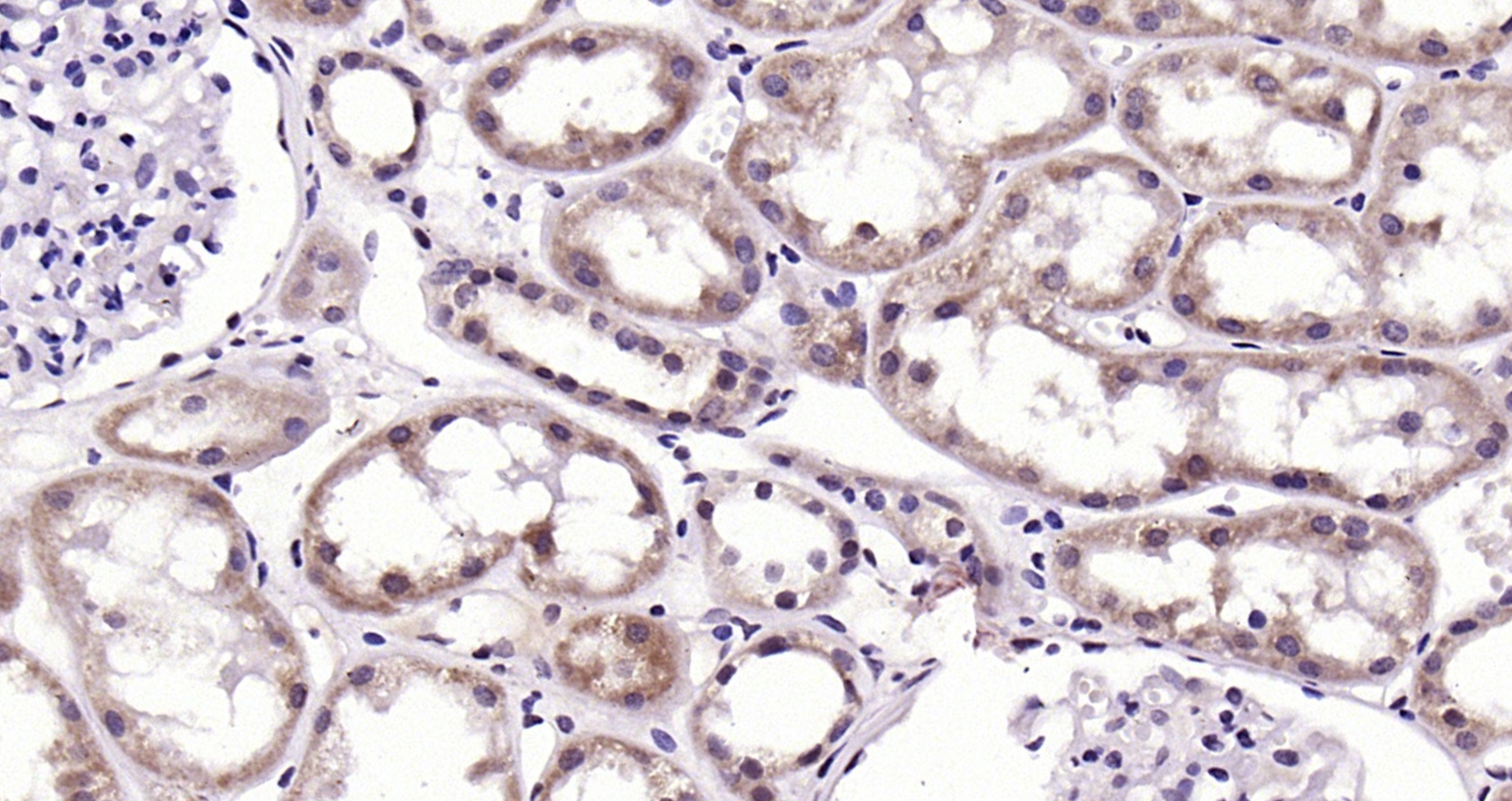 Paraformaldehyde-fixed, paraffin embedded Human kidney; Antigen retrieval by boiling in sodium citrate buffer (pH6.0) for 15min; Block endogenous peroxidase by 3% hydrogen peroxide for 20 minutes; Blocking buffer (normal goat serum) at 37°C for 30min; Antibody incubation with GSK-3 beta (NT) Polyclonal Antibody, Unconjugated (bs-0023M) at 1:200 overnight at 4°C, DAB staining.