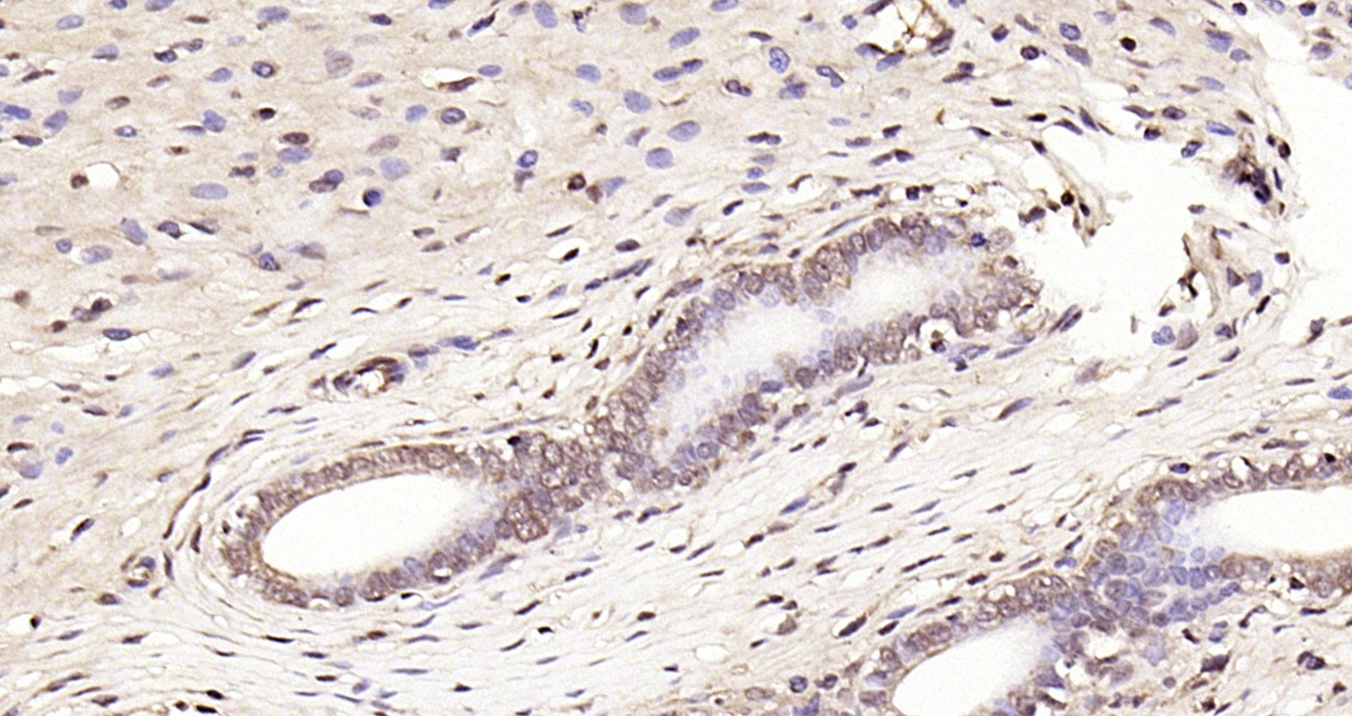 Paraformaldehyde-fixed, paraffin embedded Rat uterus; Antigen retrieval by boiling in sodium citrate buffer (pH6.0) for 15min; Block endogenous peroxidase by 3% hydrogen peroxide for 20 minutes; Blocking buffer (normal goat serum) at 37°C for 30min; Antibody incubation with GPR30 Polyclonal Antibody, Unconjugated (bs-1380R) at 1:200 overnight at 4°C, DAB staining.