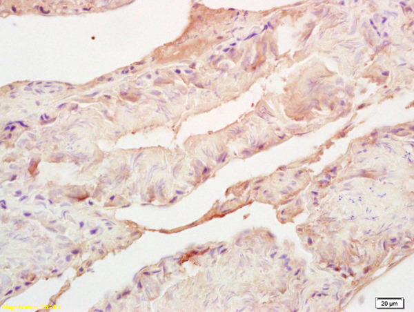 Formalin-fixed and paraffin embedded mouse testis labeled with Rabbit Anti Adrenodoxin/FDX Polyclonal Antibody, Unconjugated (bs-11426R) at 1:200 followed by conjugation to the secondary antibody and DAB staining
