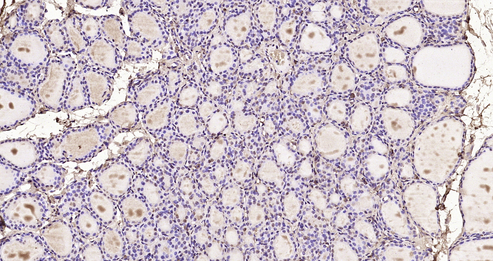 Paraformaldehyde-fixed, paraffin embedded Rat thyroid; Antigen retrieval by boiling in sodium citrate buffer (pH6.0) for 15min; Block endogenous peroxidase by 3% hydrogen peroxide for 20 minutes; Blocking buffer (normal goat serum) at 37°C for 30min; Antibody incubation with KIAA1456 Polyclonal Antibody, Unconjugated (bs-17007R) at 1:200 overnight at 4°C, DAB staining.