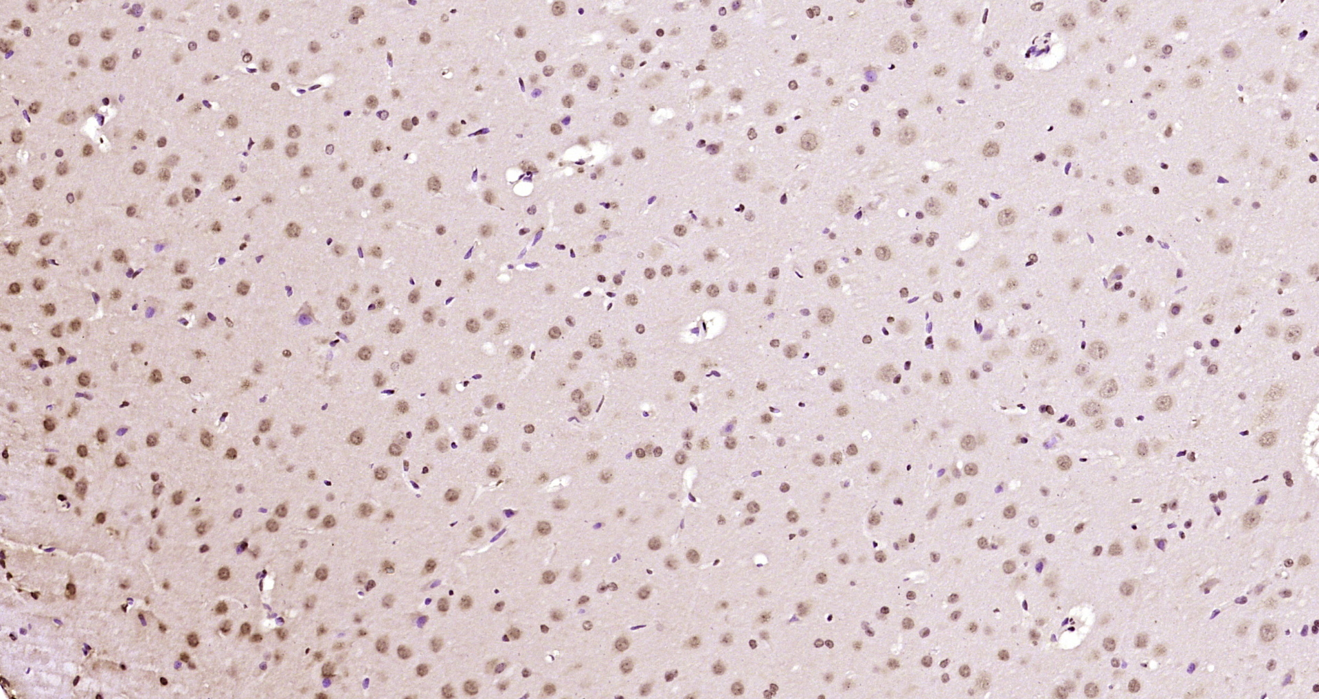 Paraformaldehyde-fixed, paraffin embedded Rat brain; Antigen retrieval by boiling in sodium citrate buffer (pH6.0) for 15min; Block endogenous peroxidase by 3% hydrogen peroxide for 20 minutes; Blocking buffer (normal goat serum) at 37°C for 30min; Antibody incubation with KIAA2022 Polyclonal Antibody, Unconjugated (bs-17033R) at 1:200 overnight at 4°C, DAB staining.
