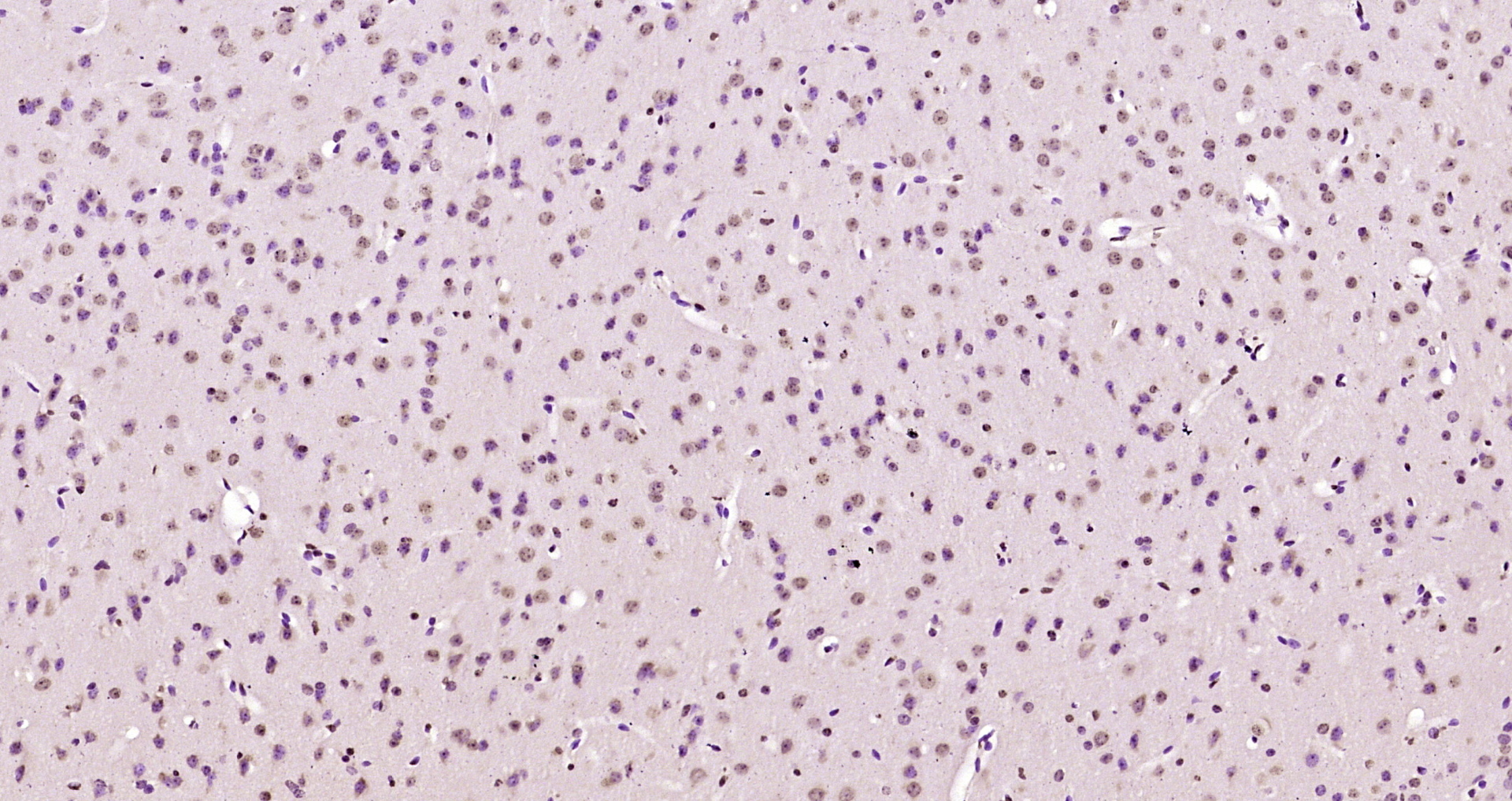 Paraformaldehyde-fixed, paraffin embedded Mouse brain; Antigen retrieval by boiling in sodium citrate buffer (pH6.0) for 15min; Block endogenous peroxidase by 3% hydrogen peroxide for 20 minutes; Blocking buffer (normal goat serum) at 37°C for 30min; Antibody incubation with KIAA2022 Polyclonal Antibody, Unconjugated (bs-17033R) at 1:200 overnight at 4°C, DAB staining.
