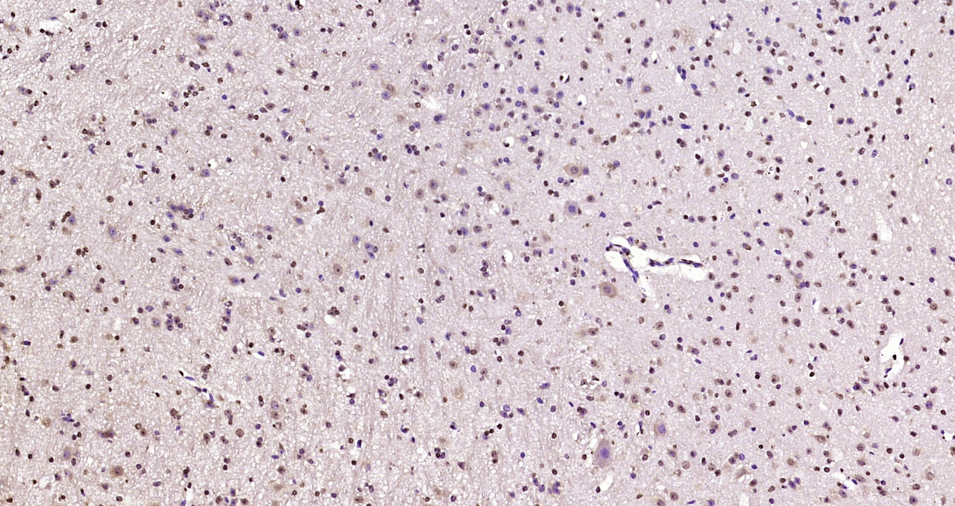 Paraformaldehyde-fixed, paraffin embedded Mouse cerebellum; Antigen retrieval by boiling in sodium citrate buffer (pH6.0) for 15min; Block endogenous peroxidase by 3% hydrogen peroxide for 20 minutes; Blocking buffer (normal goat serum) at 37°C for 30min; Antibody incubation with KIAA2022 Polyclonal Antibody, Unconjugated (bs-17033R) at 1:200 overnight at 4°C, DAB staining.