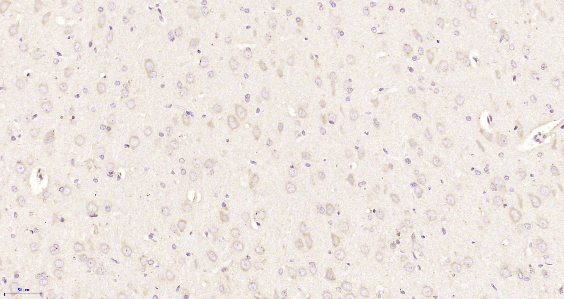 Paraformaldehyde-fixed, paraffin embedded Rat brain; Antigen retrieval by boiling in sodium citrate buffer (pH6.0) for 15min; Block endogenous peroxidase by 3% hydrogen peroxide for 20 minutes; Blocking buffer (normal goat serum) at 37°C for 30min; Antibody incubation with KIF2A Polyclonal Antibody, Unconjugated (bs-17055R) at 1:200 overnight at 4°C, DAB staining.