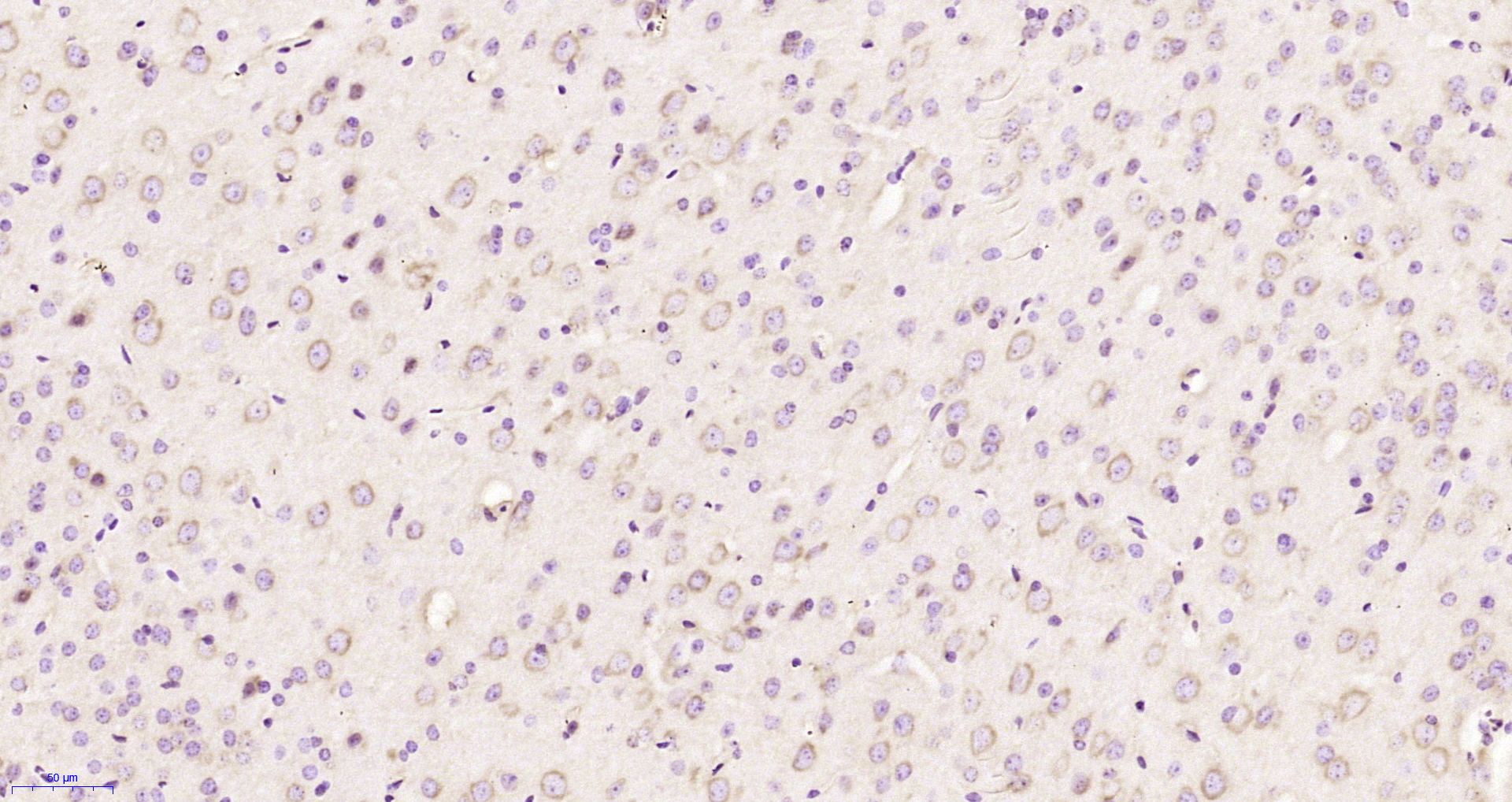 Paraformaldehyde-fixed, paraffin embedded Mouse brain; Antigen retrieval by boiling in sodium citrate buffer (pH6.0) for 15min; Block endogenous peroxidase by 3% hydrogen peroxide for 20 minutes; Blocking buffer (normal goat serum) at 37°C for 30min; Antibody incubation with Kindlin Polyclonal Antibody, Unconjugated (bs-17063R) at 1:200 overnight at 4°C, DAB staining.