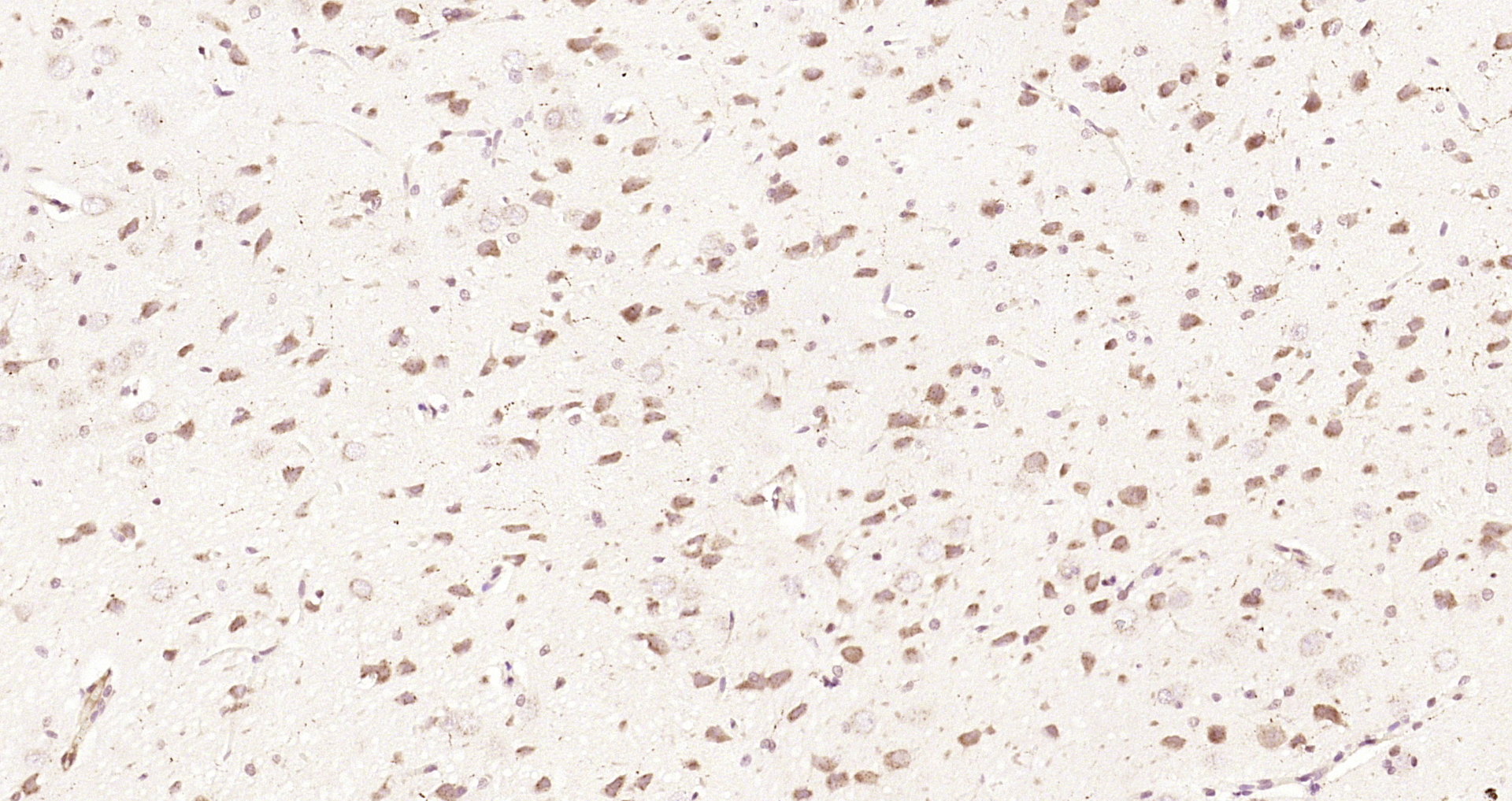 Paraformaldehyde-fixed, paraffin embedded Rat brain; Antigen retrieval by boiling in sodium citrate buffer (pH6.0) for 15min; Block endogenous peroxidase by 3% hydrogen peroxide for 20 minutes; Blocking buffer (normal goat serum) at 37°C for 30min; Antibody incubation with Karyopherin beta 3 Polyclonal Antibody, Unconjugated (bs-17075R) at 1:200 overnight at 4°C, DAB staining.