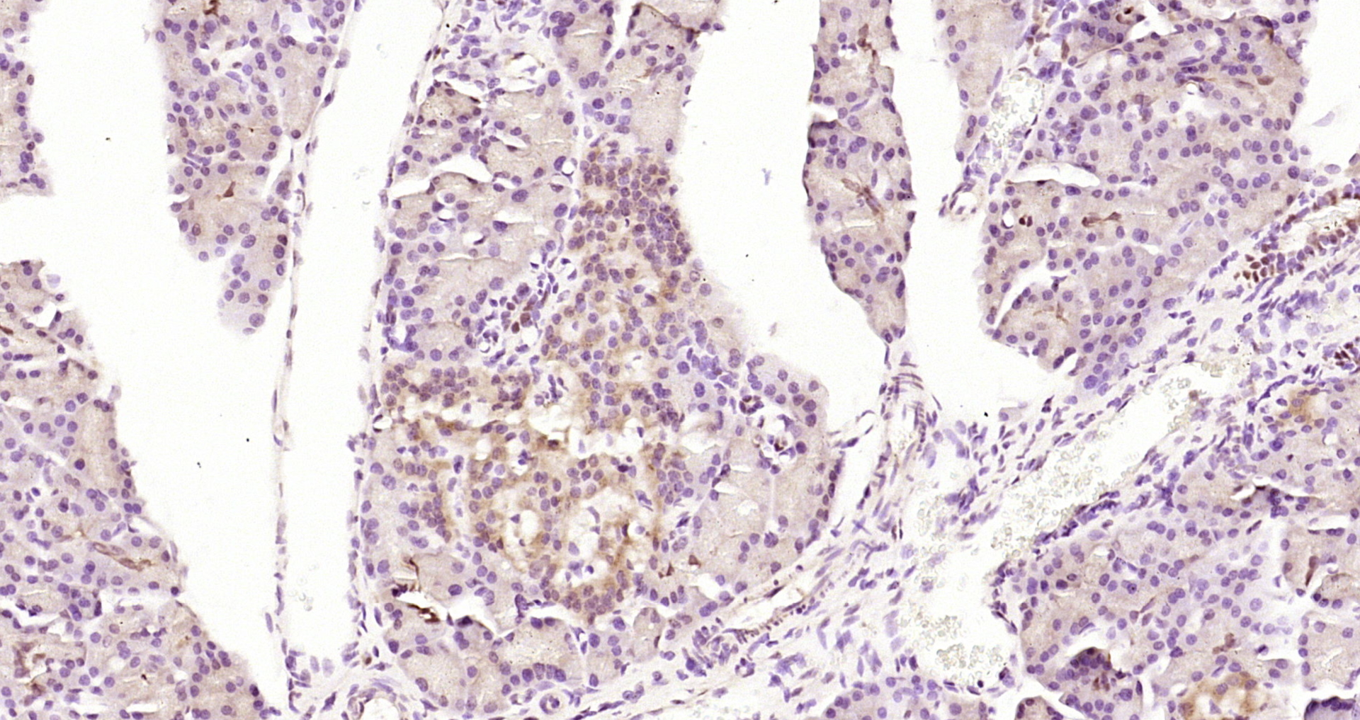 Paraformaldehyde-fixed, paraffin embedded Rat pancreas; Antigen retrieval by boiling in sodium citrate buffer (pH6.0) for 15min; Block endogenous peroxidase by 3% hydrogen peroxide for 20 minutes; Blocking buffer (normal goat serum) at 37°C for 30min; Antibody incubation with Karyopherin beta 3 Polyclonal Antibody, Unconjugated (bs-17075R) at 1:200 overnight at 4°C, DAB staining.