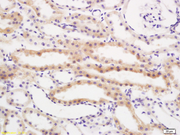 Formalin-fixed and paraffin embedded rat kidney labeled with Anti RBBP6/P2P-R Polyclonal Antibody, Unconjugated (bs-1483R) at 1:200 followed by conjugation to the secondary antibody and DAB staining