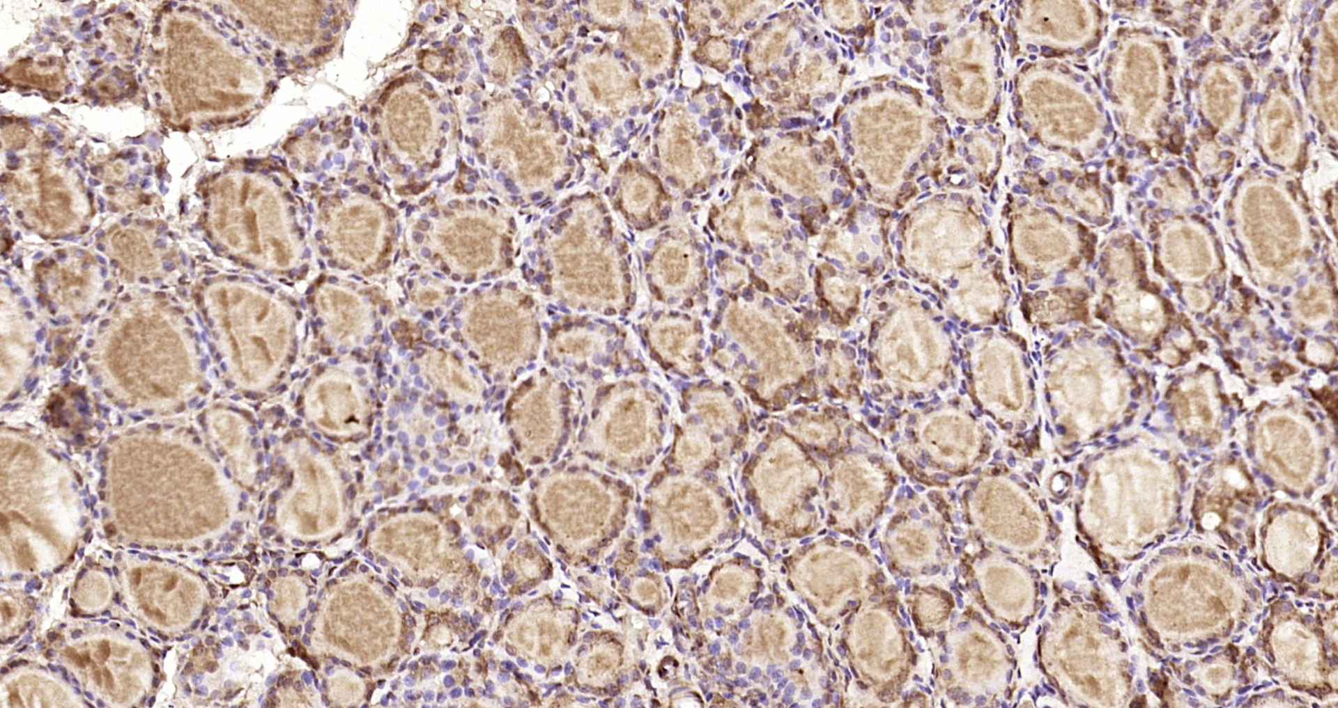 Paraformaldehyde-fixed, paraffin embedded Rat thyroid; Antigen retrieval by boiling in sodium citrate buffer (pH6.0) for 15min; Block endogenous peroxidase by 3% hydrogen peroxide for 20 minutes; Blocking buffer (normal goat serum) at 37°C for 30min; Antibody incubation with RNF109/TRIM56 Polyclonal Antibody, Unconjugated (bs-17116R) at 1:200 overnight at 4°C, DAB staining.