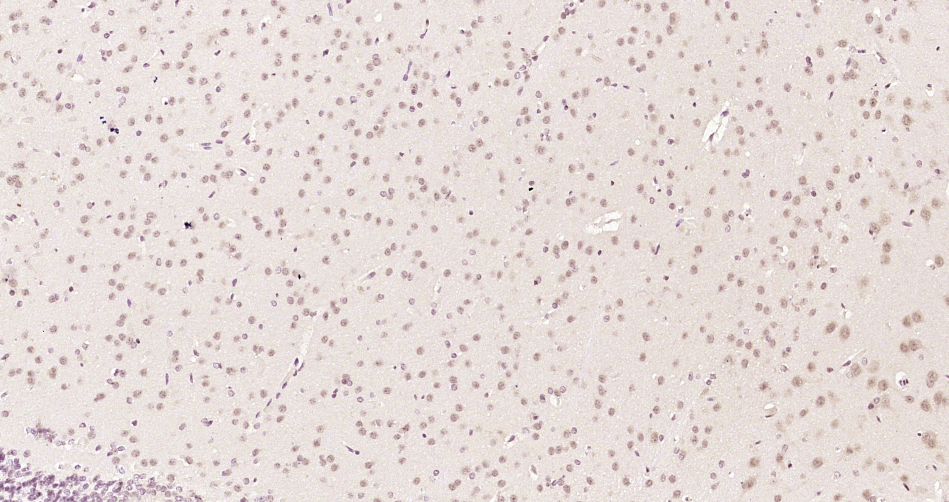 Paraformaldehyde-fixed, paraffin embedded Rat brain; Antigen retrieval by boiling in sodium citrate buffer (pH6.0) for 15min; Block endogenous peroxidase by 3% hydrogen peroxide for 20 minutes; Blocking buffer (normal goat serum) at 37°C for 30min; Antibody incubation with Ataxin 3 Polyclonal Antibody, Unconjugated (bs-17208R) at 1:200 overnight at 4°C, DAB staining.
