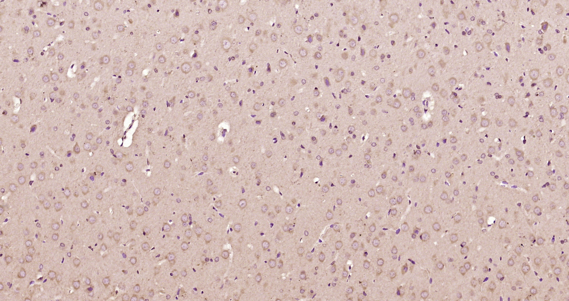 Paraformaldehyde-fixed, paraffin embedded Rat brain; Antigen retrieval by boiling in sodium citrate buffer (pH6.0) for 15min; Block endogenous peroxidase by 3% hydrogen peroxide for 20 minutes; Blocking buffer (normal goat serum) at 37°C for 30min; Antibody incubation with TOMM40 Polyclonal Antibody, Unconjugated (bs-17227R) at 1:200 overnight at 4°C, DAB staining.